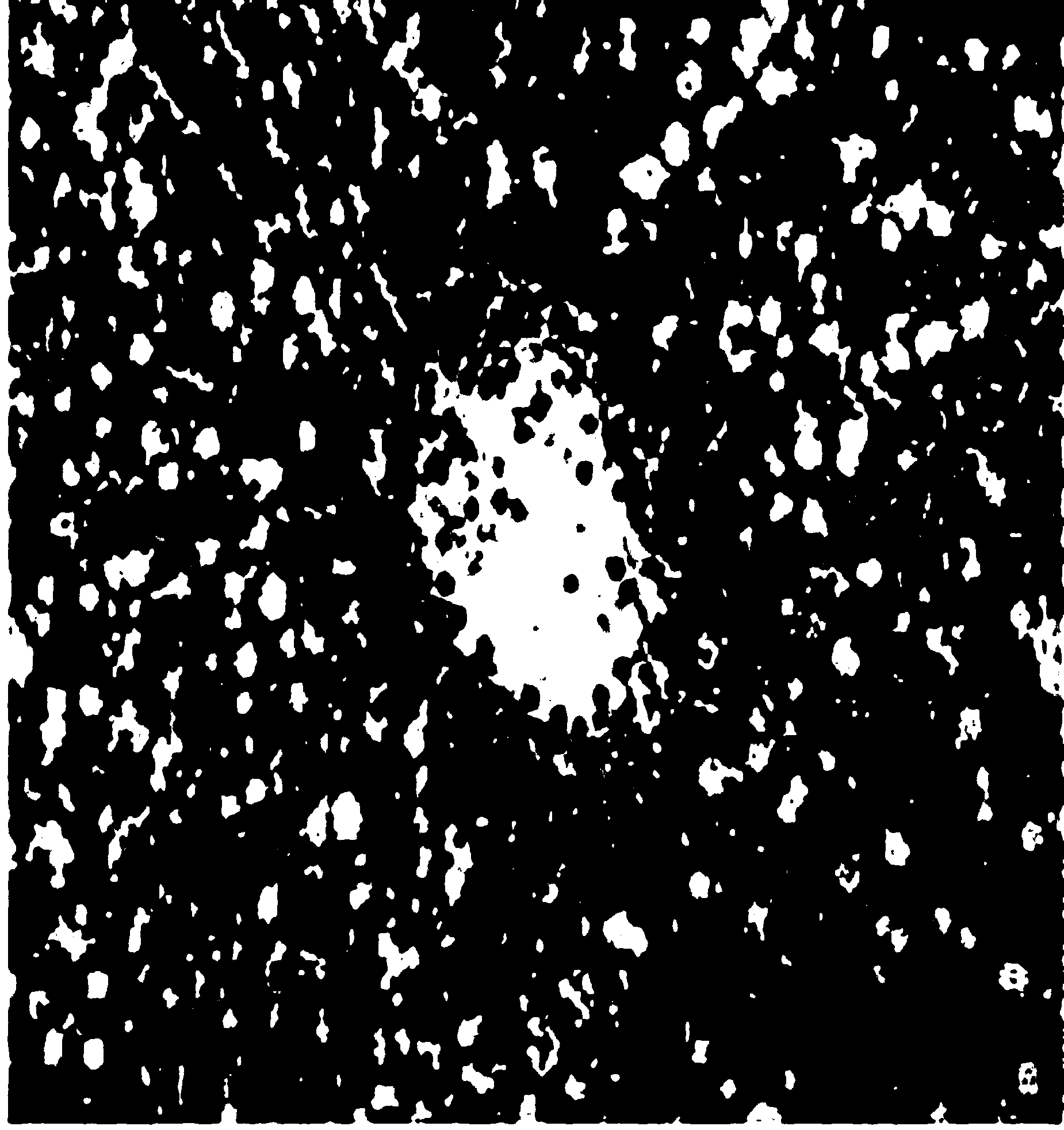 Portulaca oleracea oral liquid for treating non-alcoholic fatty liver and preparation method thereof