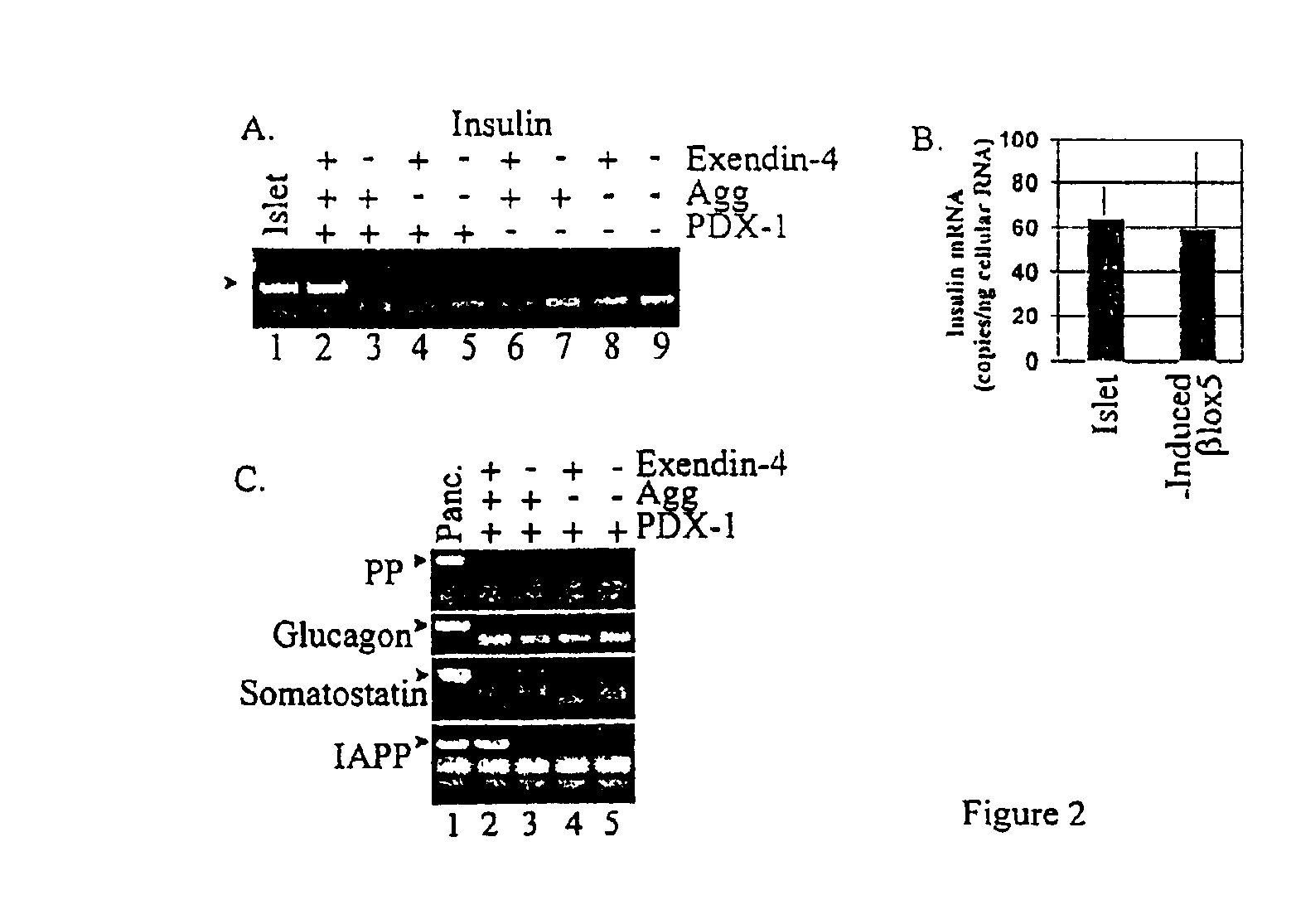 Induction of beta cell differentiation in human cells by stimulation of the GLP-1 receptor