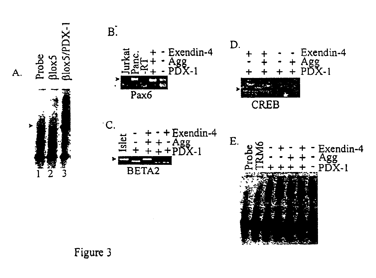 Induction of beta cell differentiation in human cells by stimulation of the GLP-1 receptor