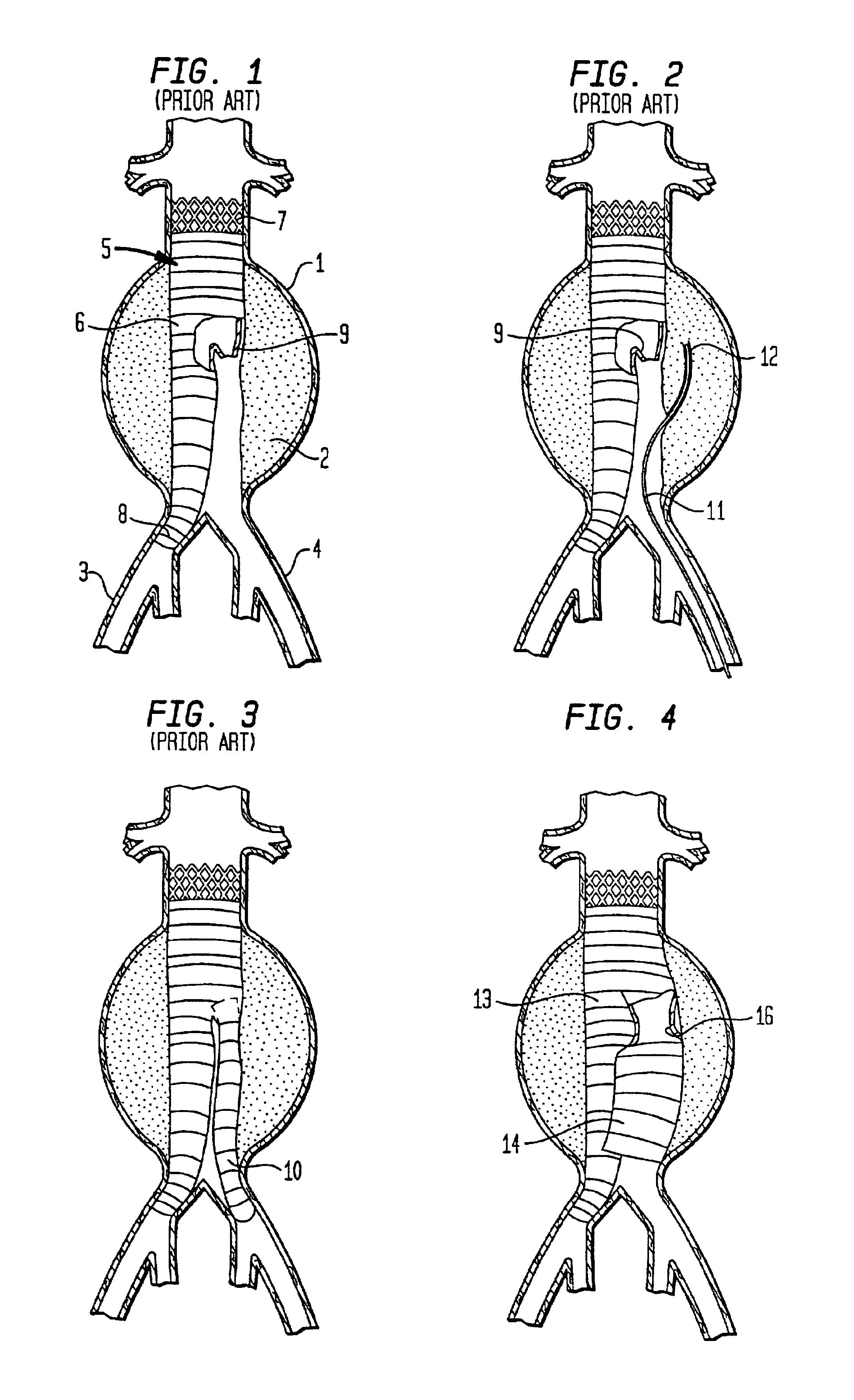 Arterial graft device