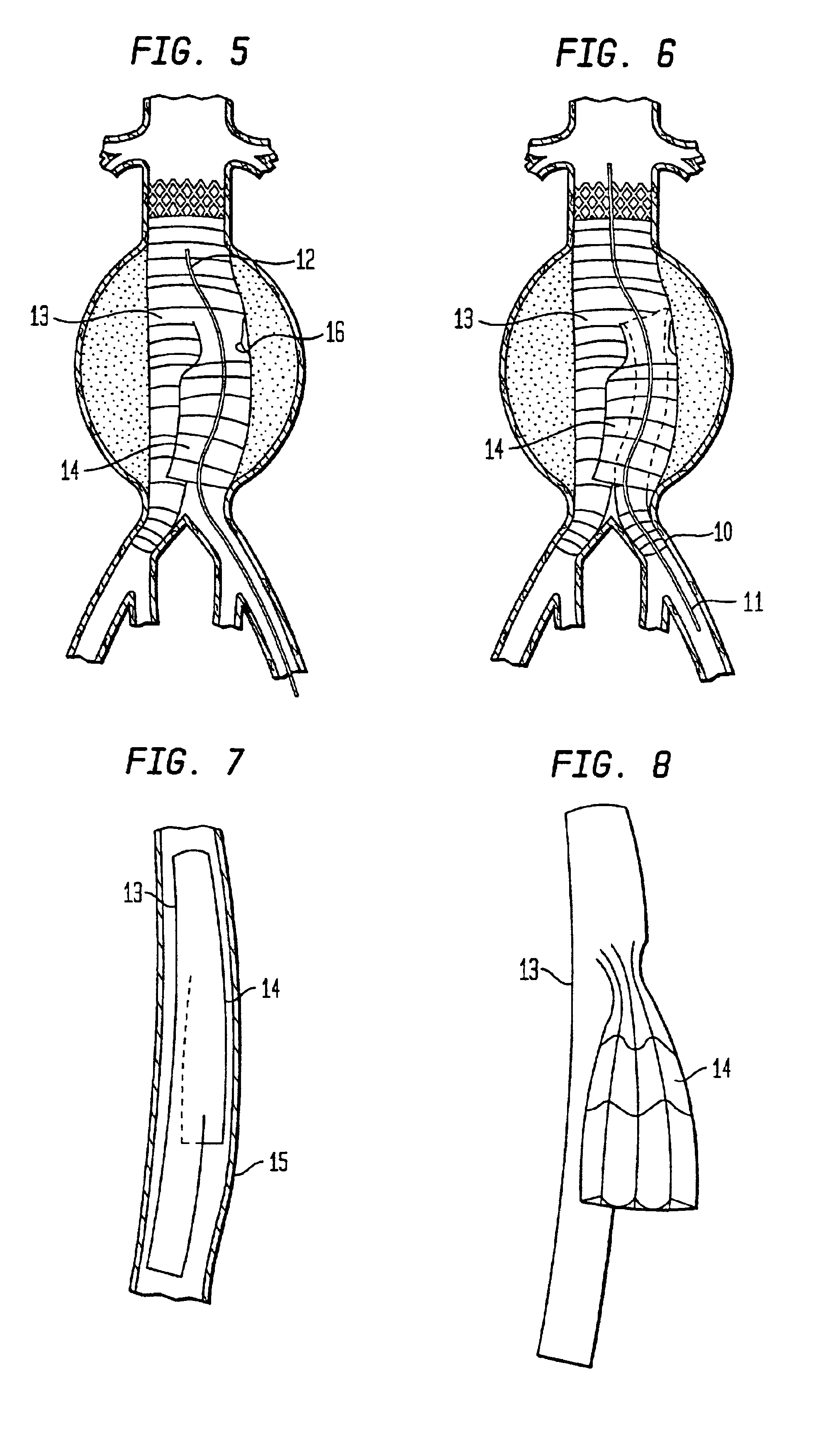 Arterial graft device