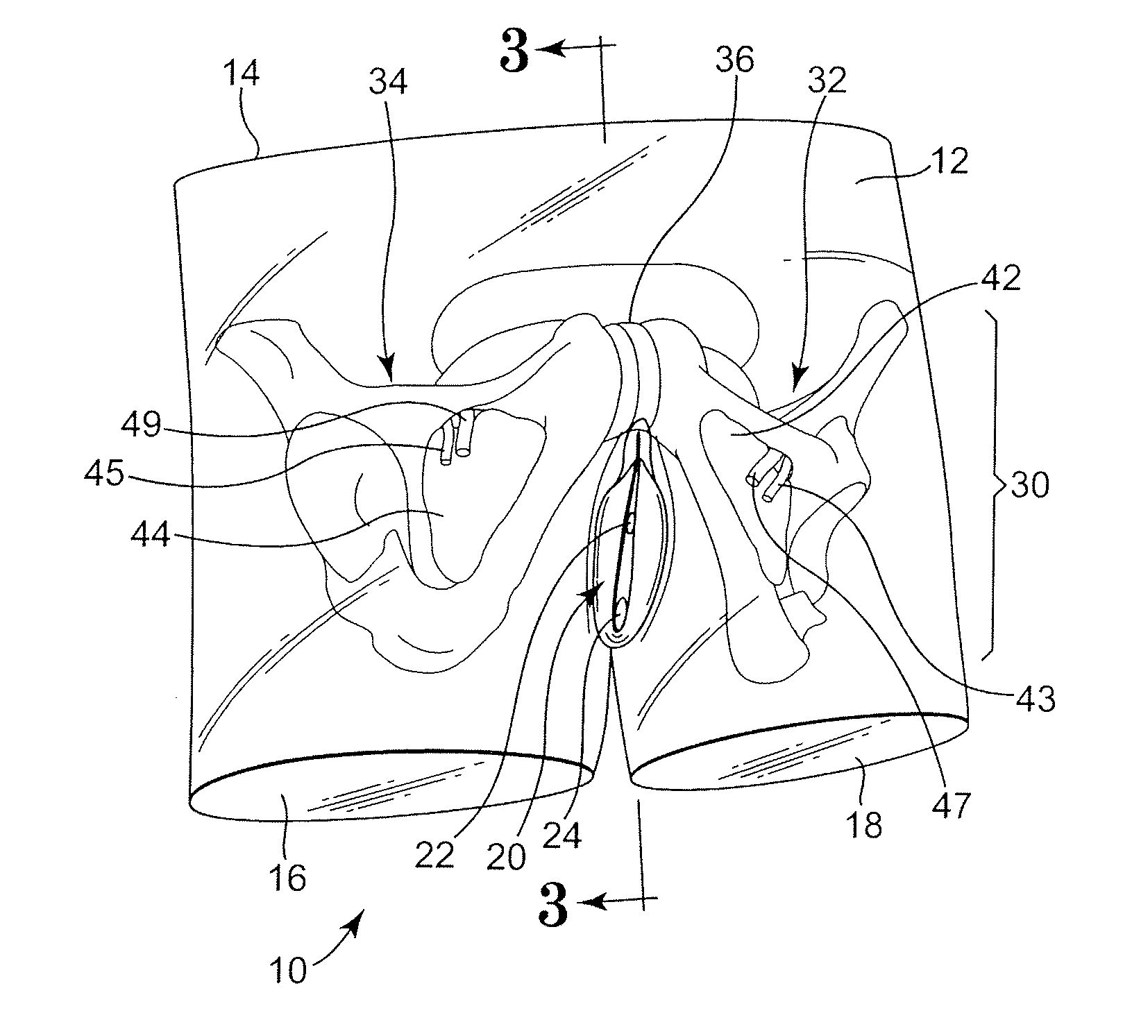 Abdominopelvic region surgical training model