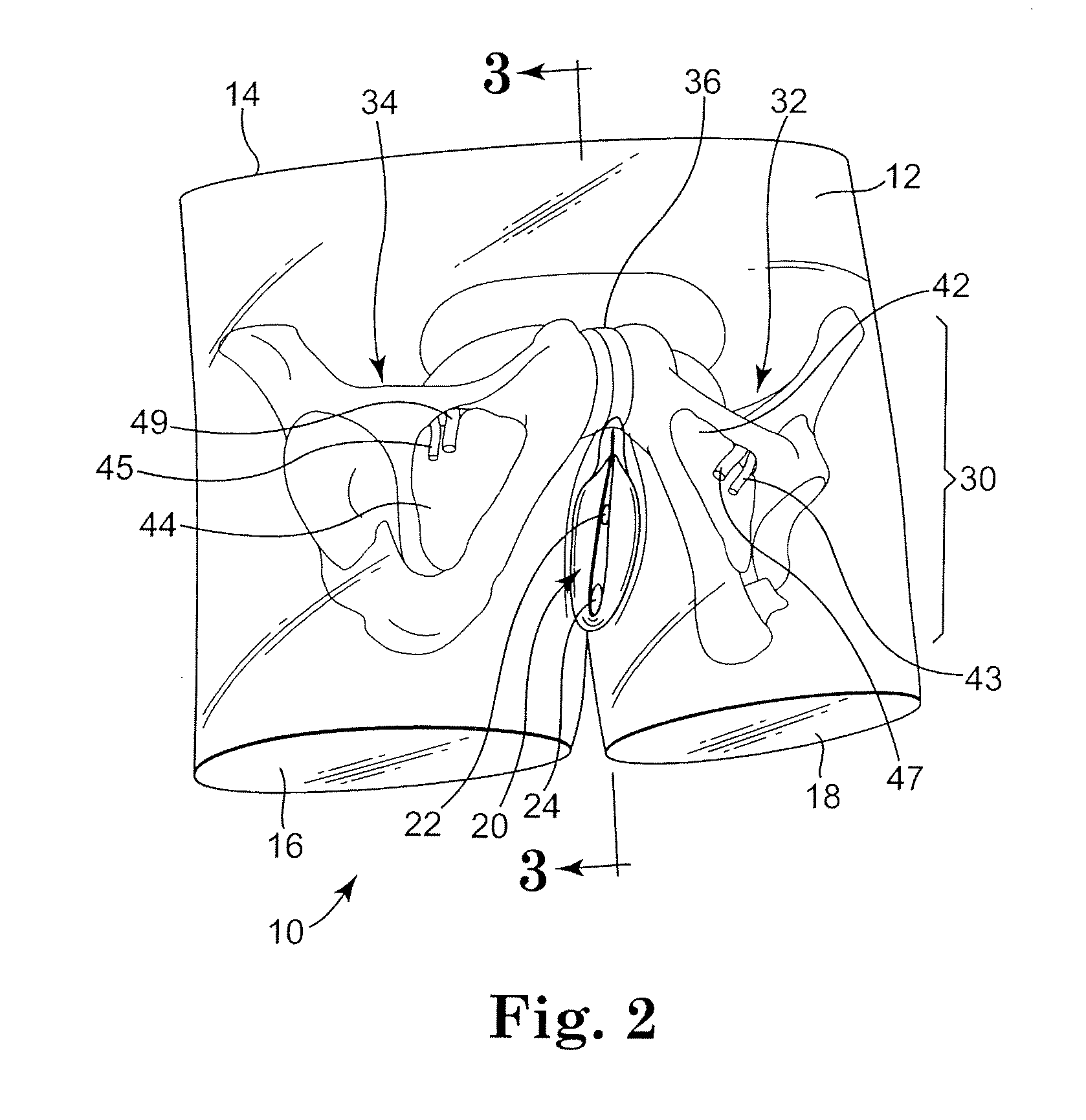 Abdominopelvic region surgical training model