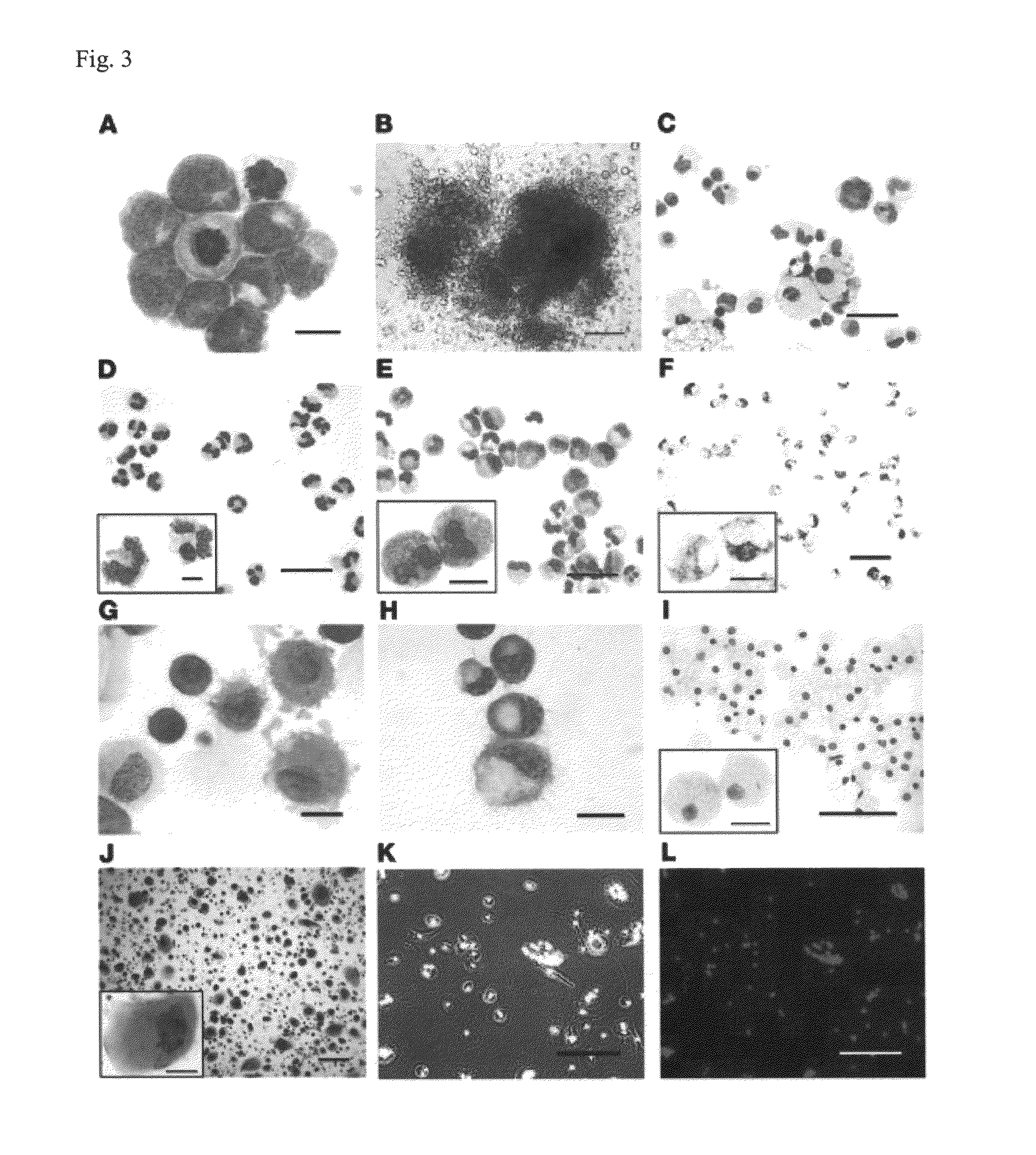 Generation of mature myelomonocytic cells through expansion and differentiation of pluripotent stem cell-derived lin<sup>-</sup>CD34<sup>+</sup>CD43<sup>+</sup>CD45<sup>+</sup>progenitors