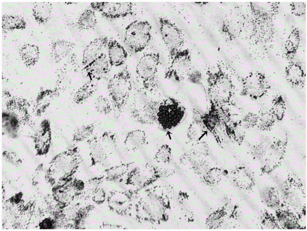 Method of separating and cultivating umbilical cord mesenchymal stem cells