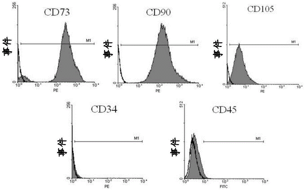 Method of separating and cultivating umbilical cord mesenchymal stem cells