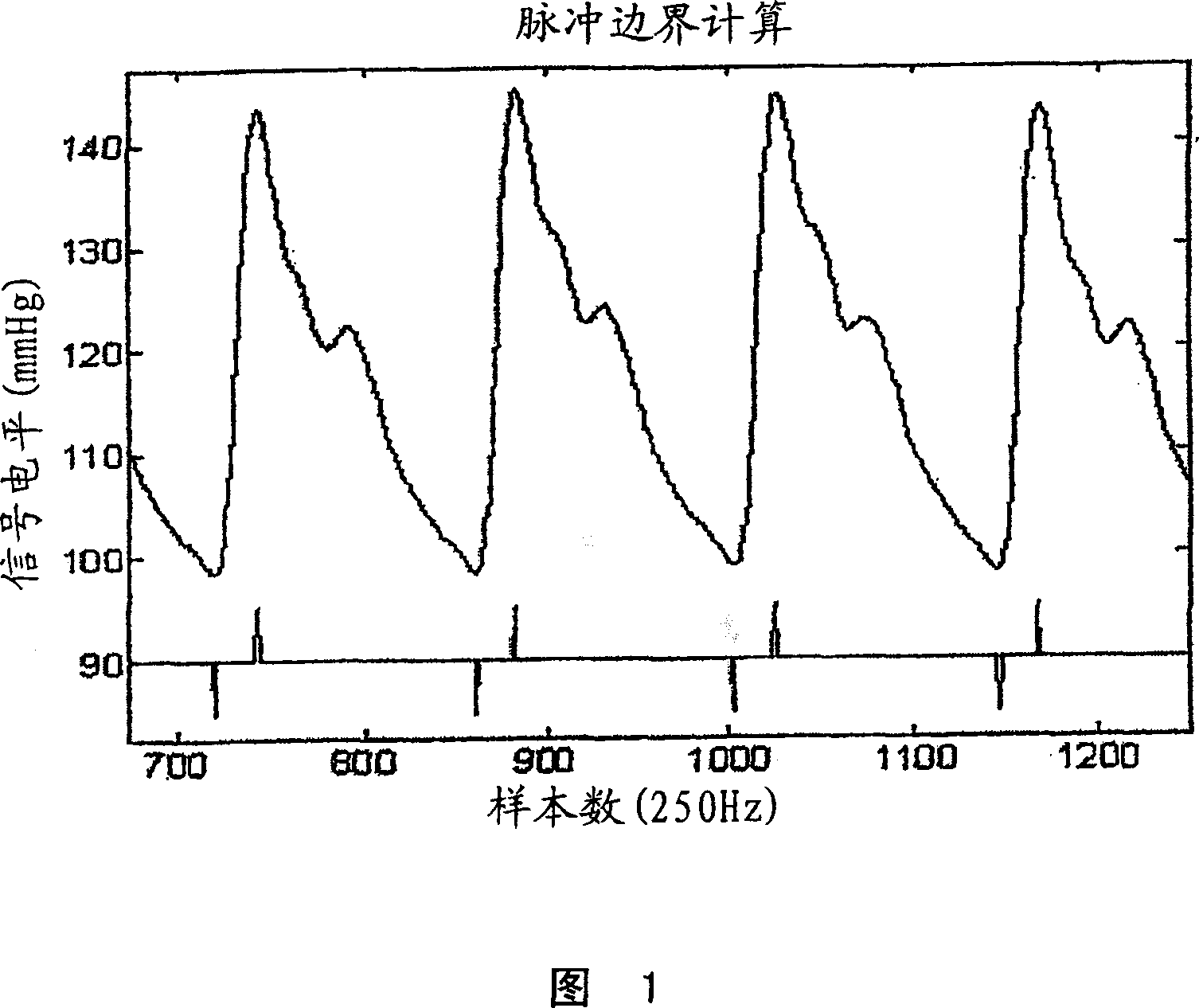 Determining intracranial pressure non-invasively by acoustic transducer