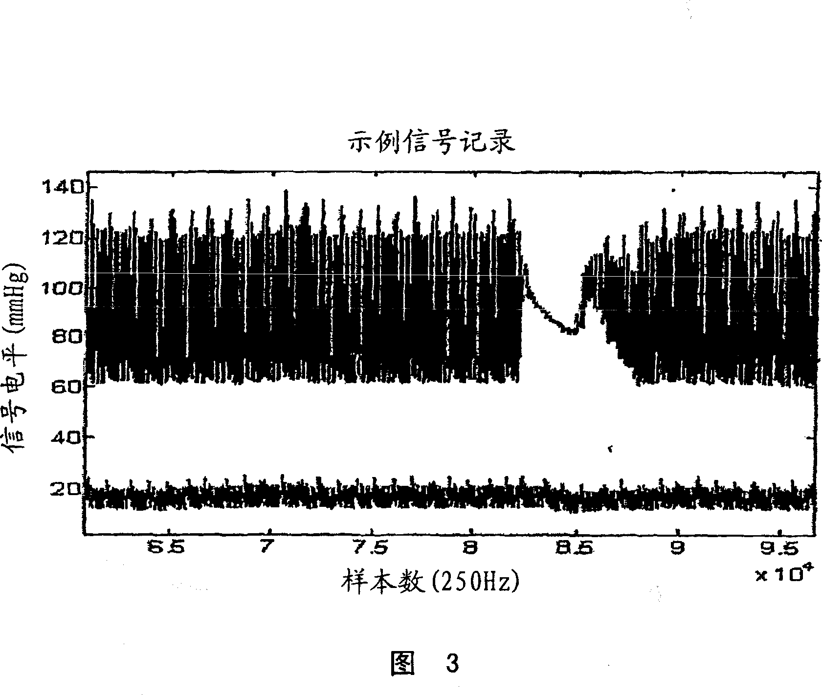 Determining intracranial pressure non-invasively by acoustic transducer