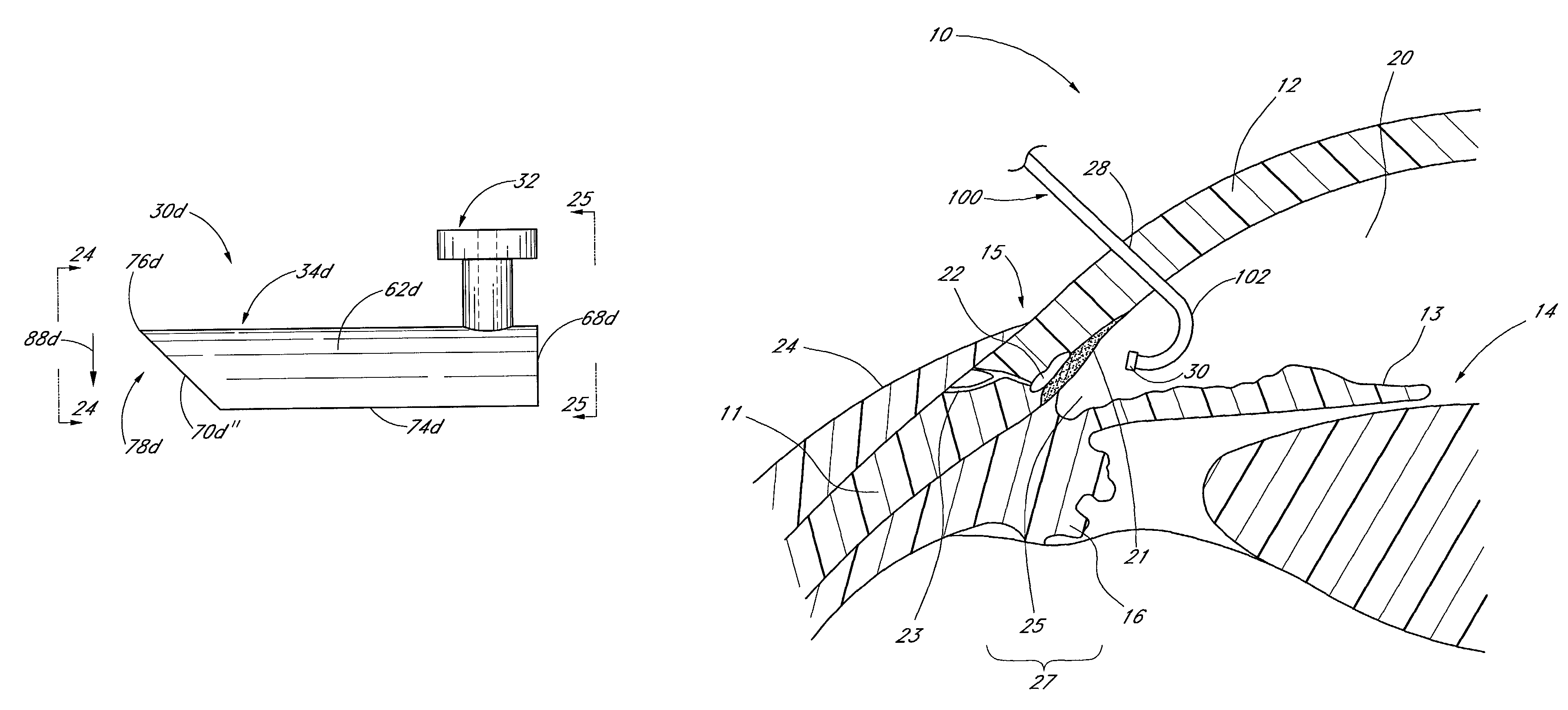 Glaucoma stent and methods thereof for glaucoma treatment