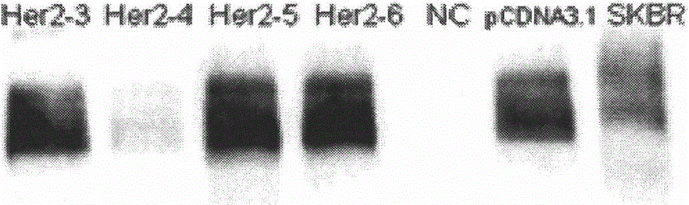 Cell strain for expressing HER2 gene, and construction method and application thereof