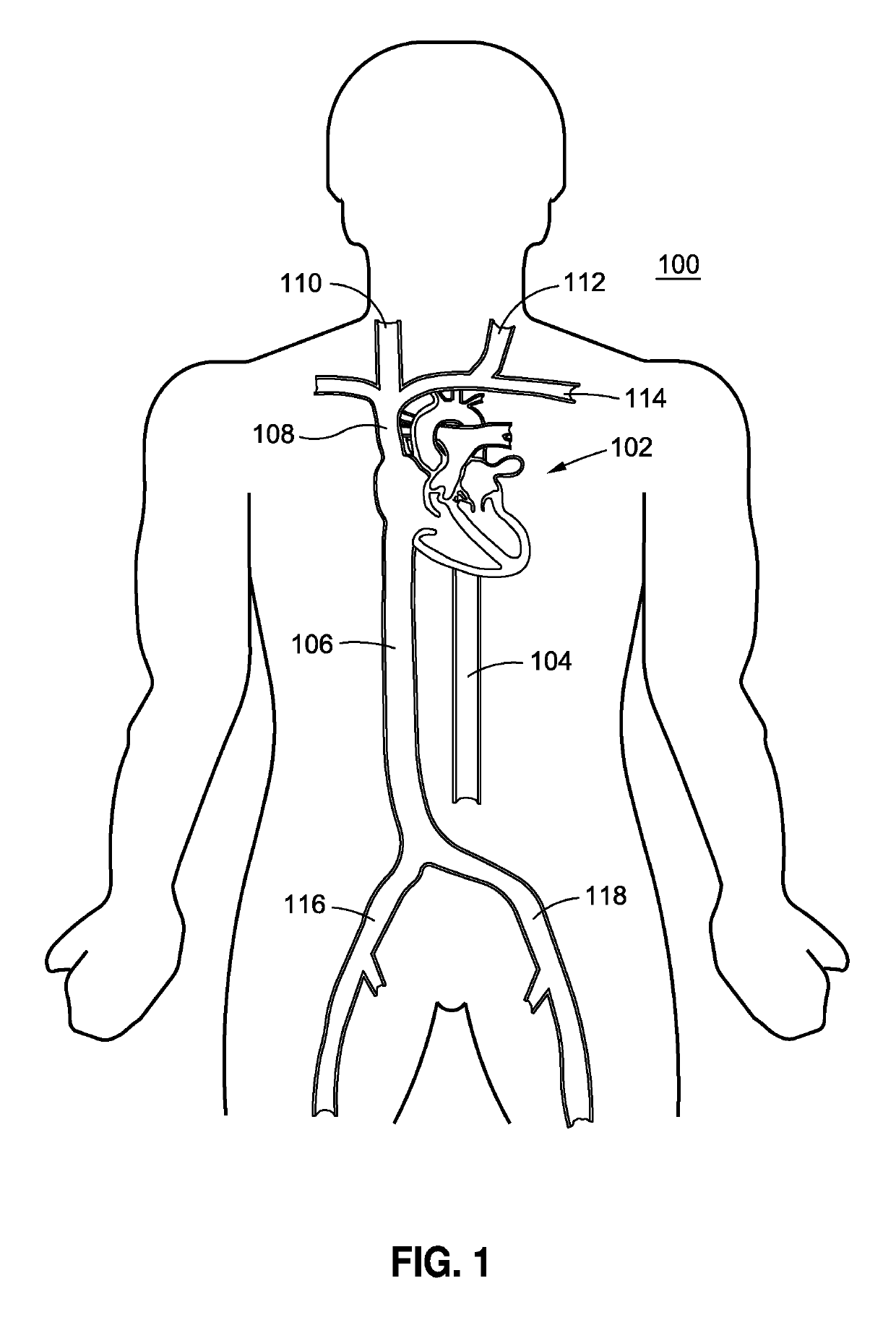 System and method for implant delivery