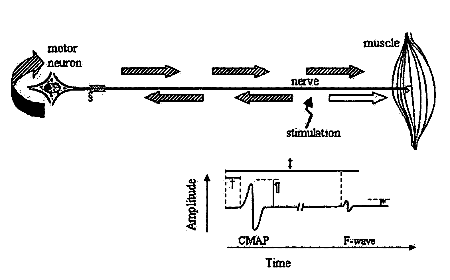 Method and apparatus for the detection of neuromuscular disease using disease specific evoked neuromuscular response analysis