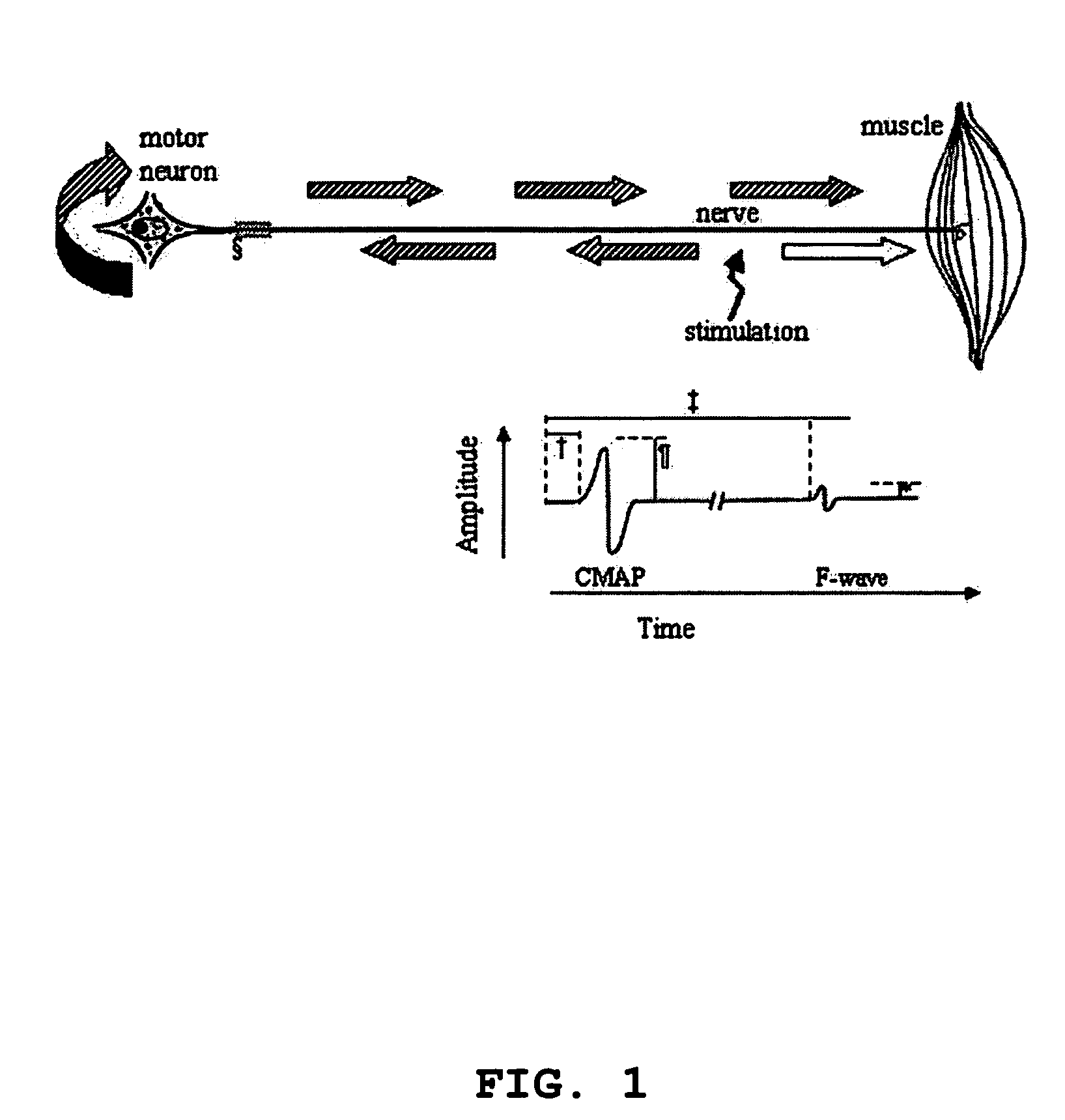 Method and apparatus for the detection of neuromuscular disease using disease specific evoked neuromuscular response analysis