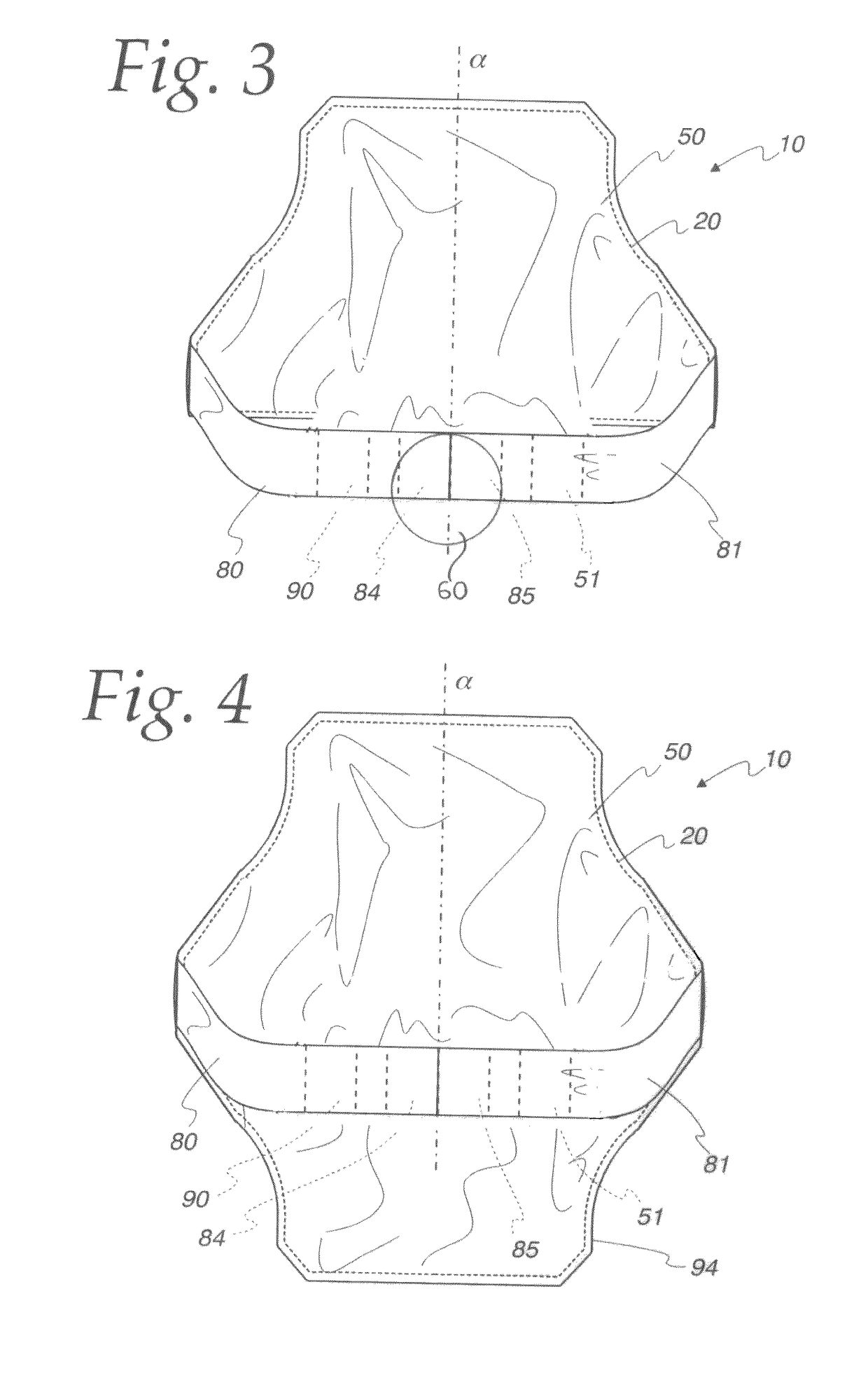 Modular neck protection device