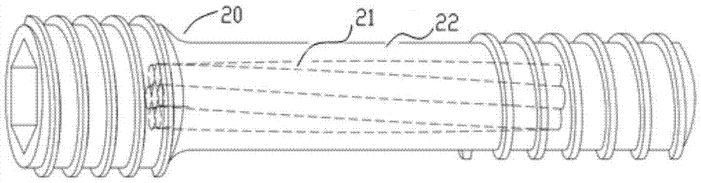 Absorbable internally-fixed implantable iron-based alloy medical apparatus