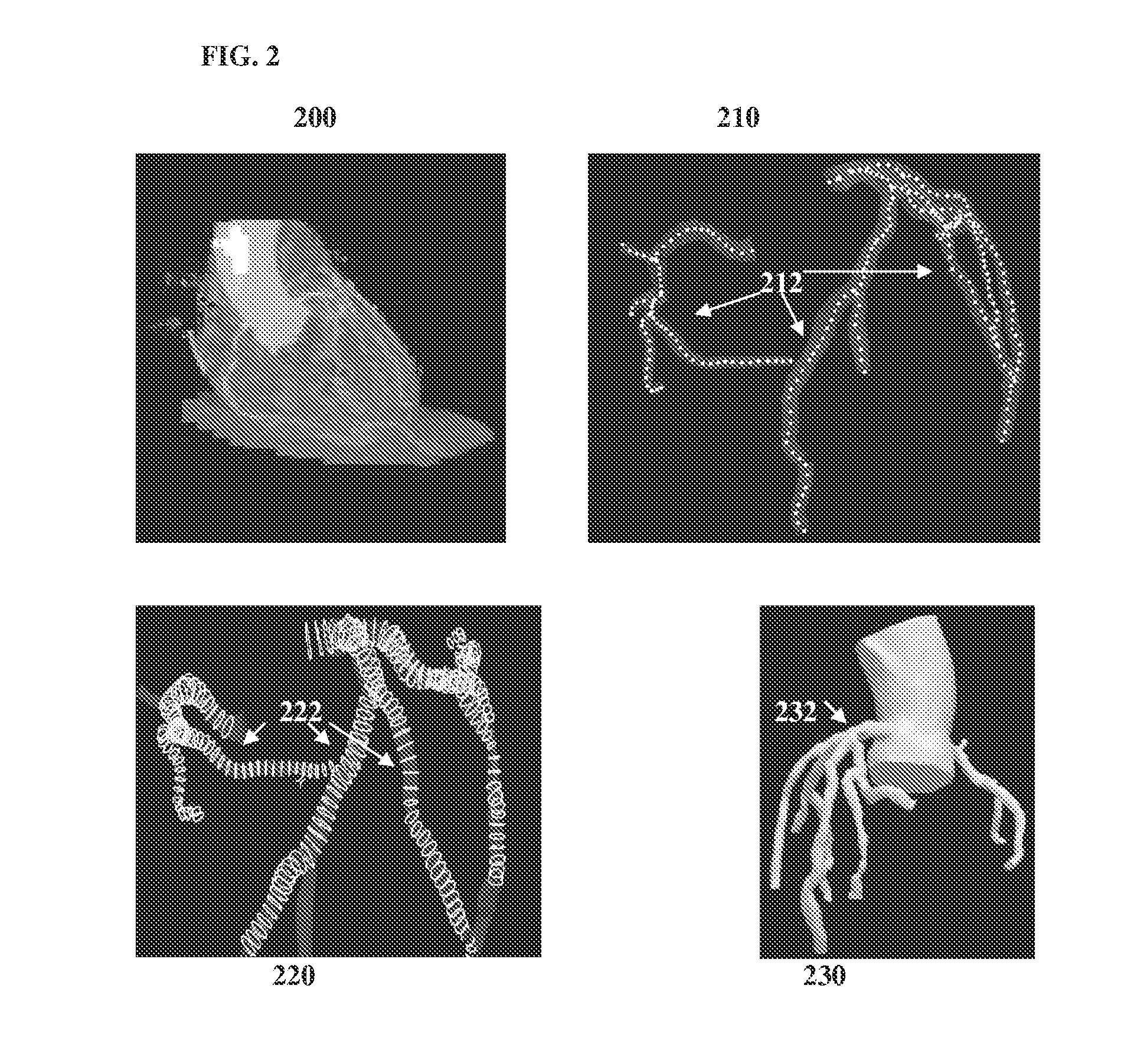 Method and system for hemodynamic computation in coronary arteries