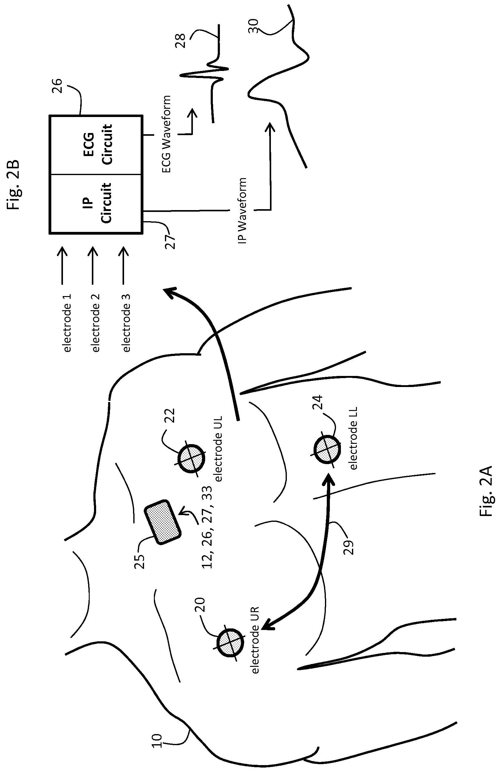 Body-worn monitor for measuring respiration rate