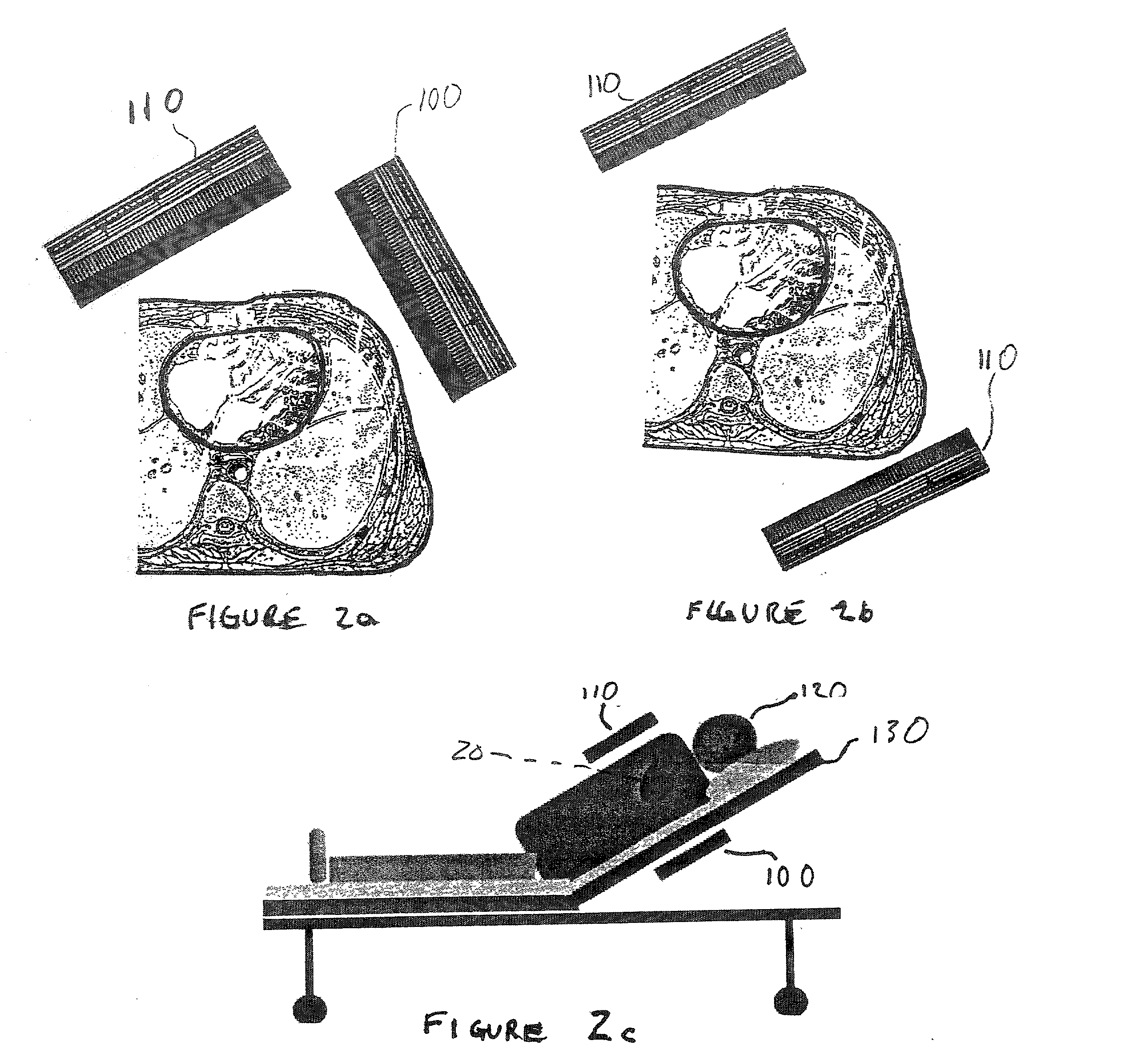 Cardiovascular imaging and functional analysis system