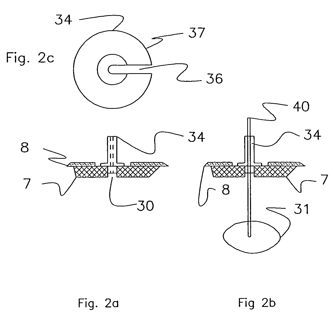 System and method for intracranial access and monitoring