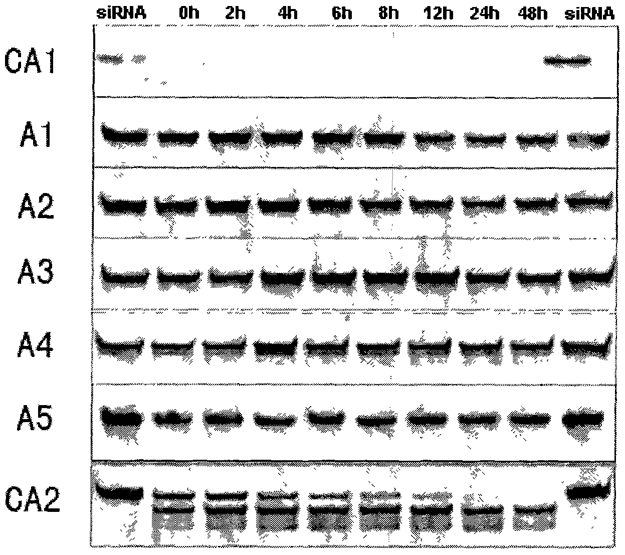 Small interfering nucleic acid and medical composite and pharmaceutical applications of nucleic acid