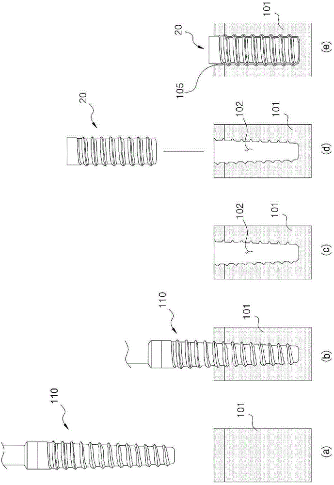 Tooth implant