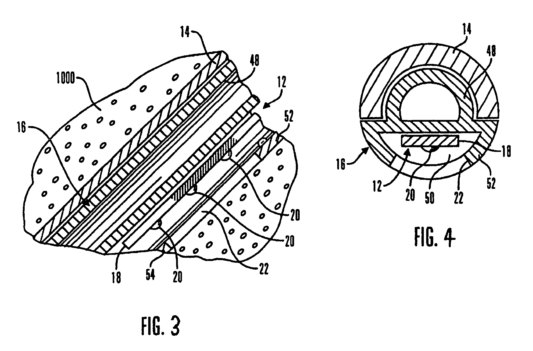 Real-time self-calibrating sensor system and method