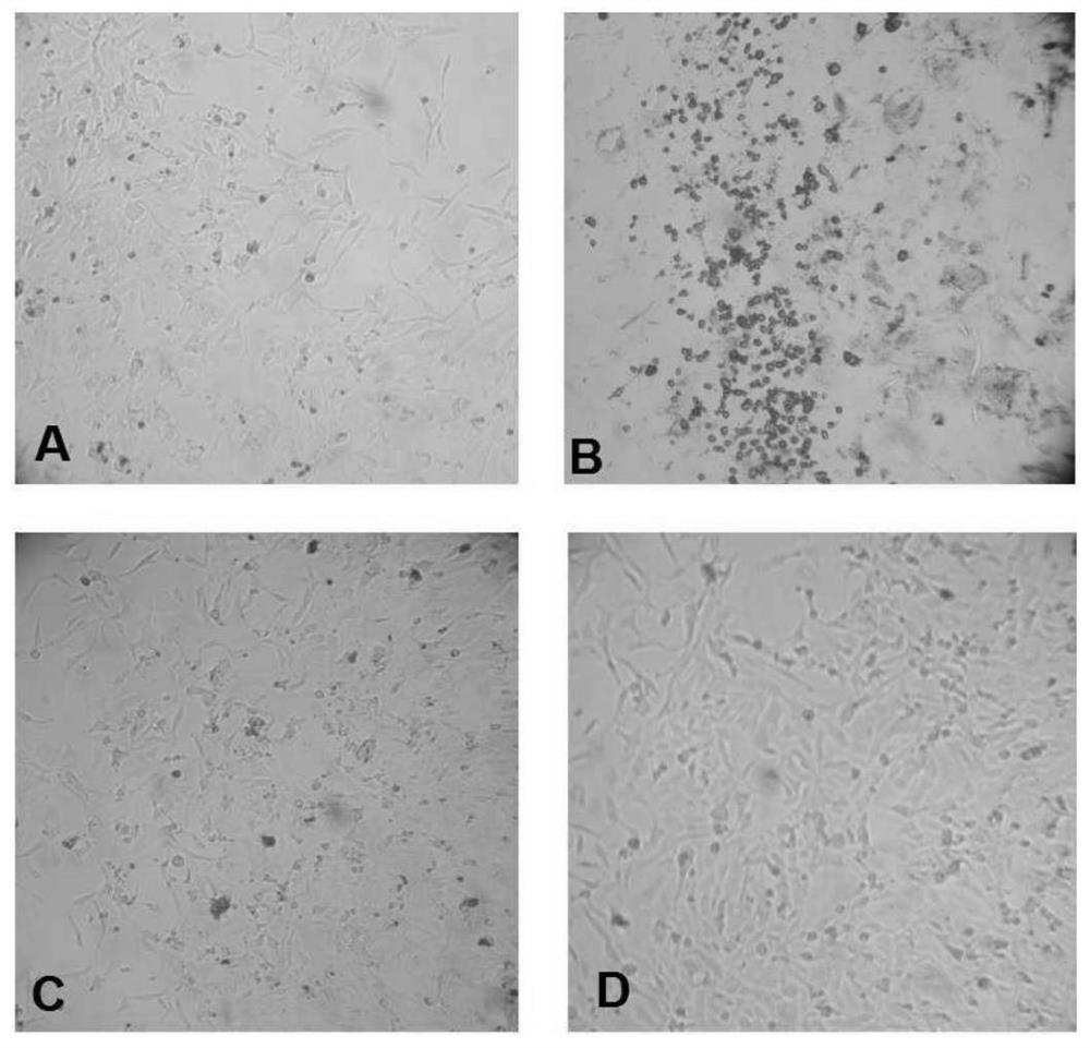 Fully humanized anti-hepatitis B virus monoclonal antibody as well as preparation method and application thereof