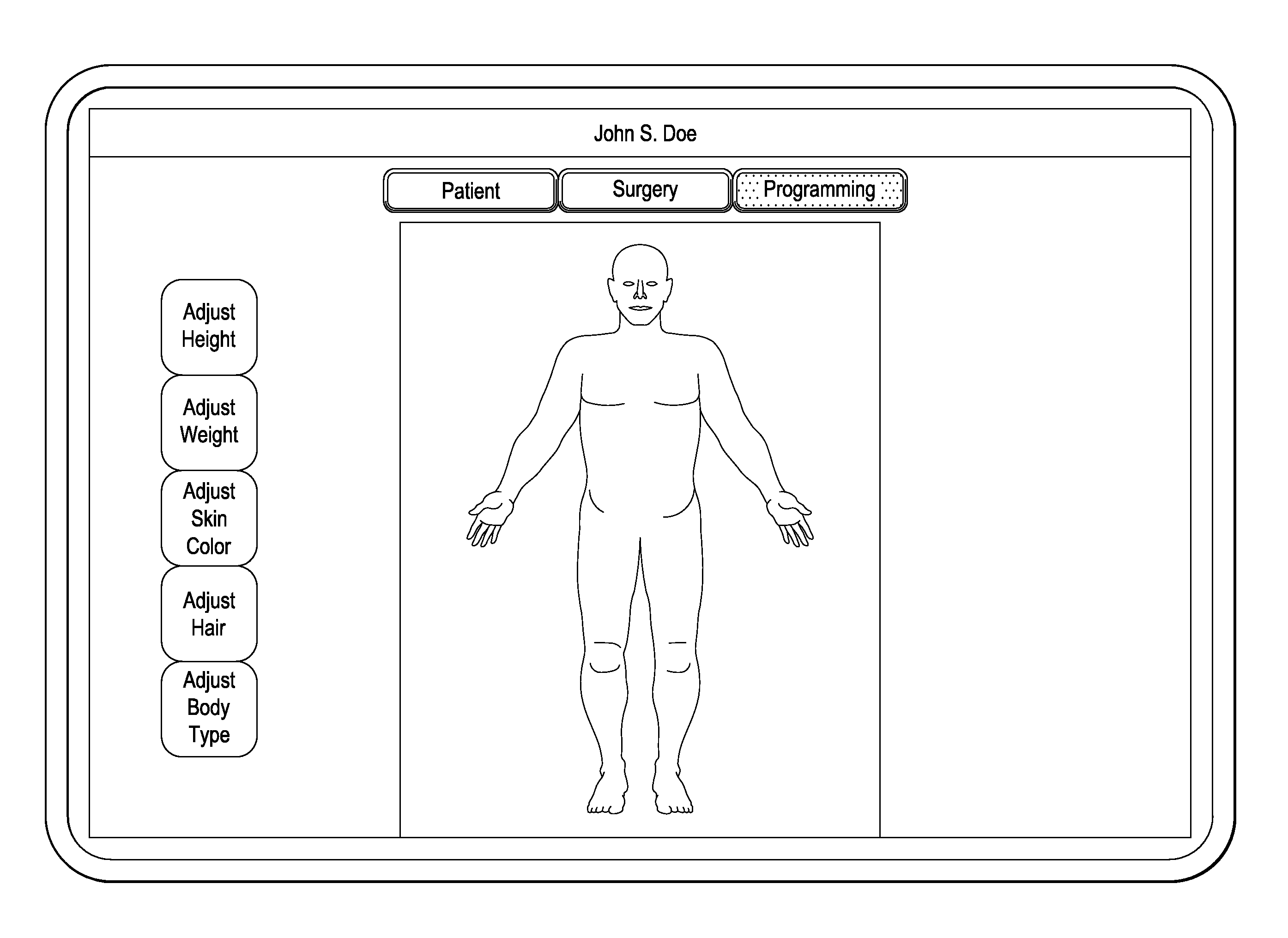 System and method of compressing medical maps for pulse generator or database storage