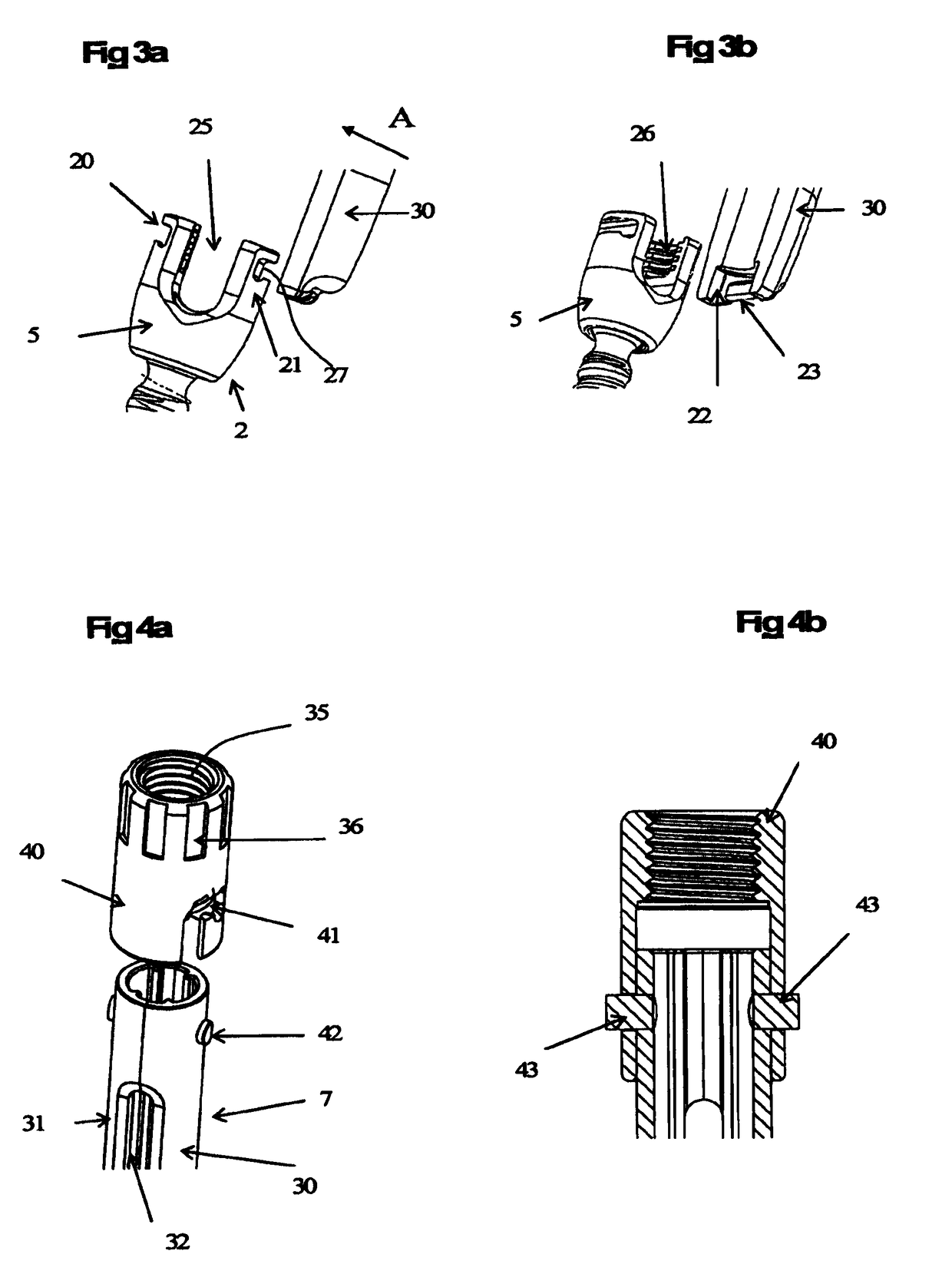 Device and method for spinal surgery