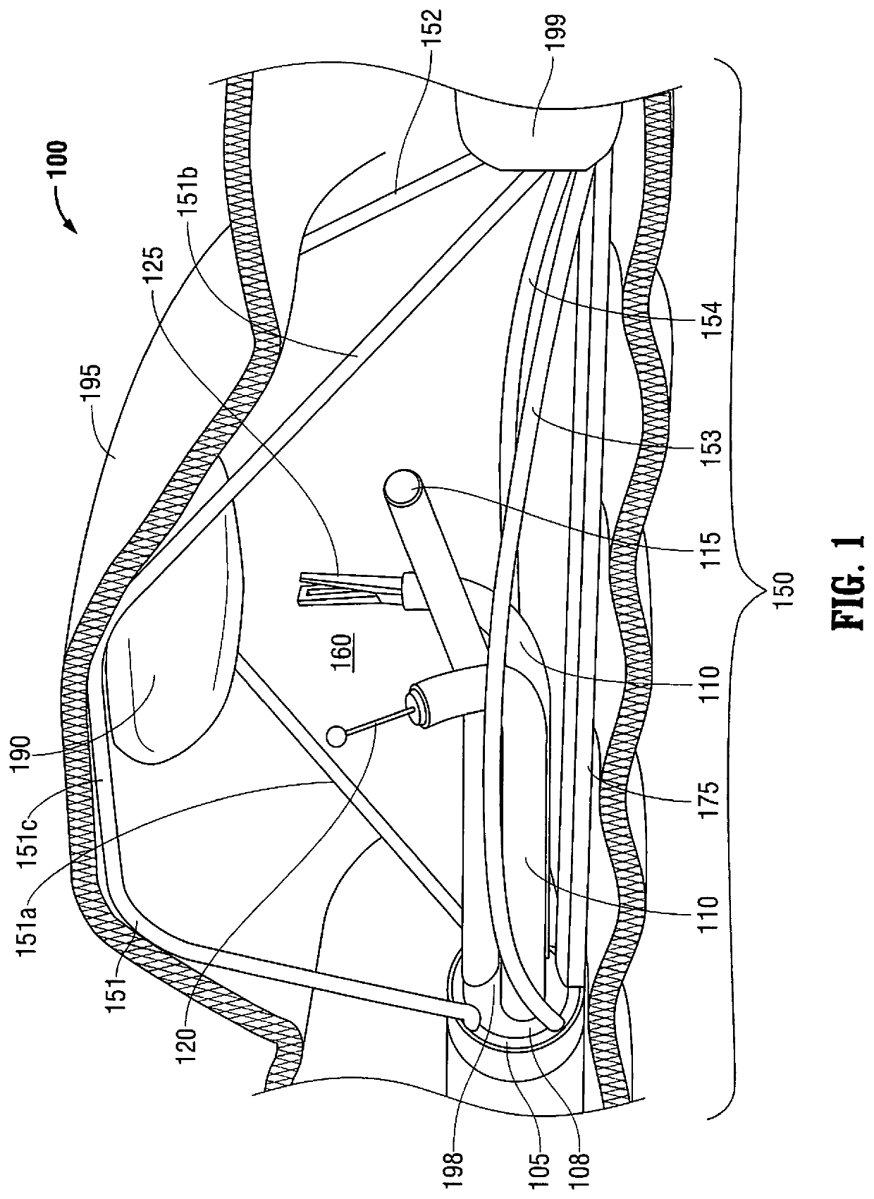 Multi-lumen-catheter retractor system for a minimally-invasive, operative gastrointestinal treatment