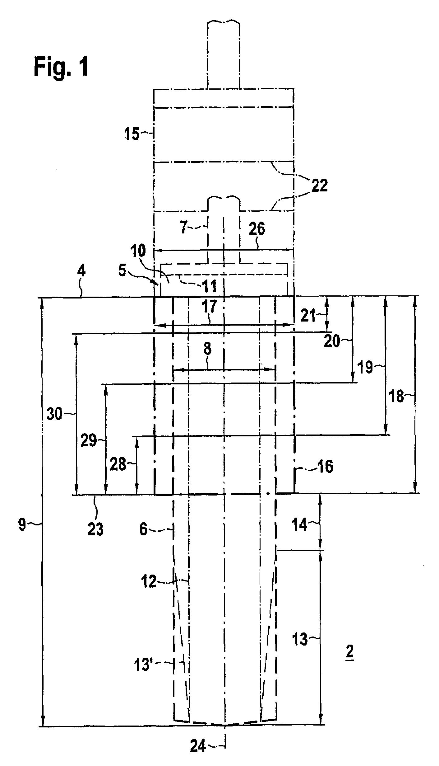 Implant system