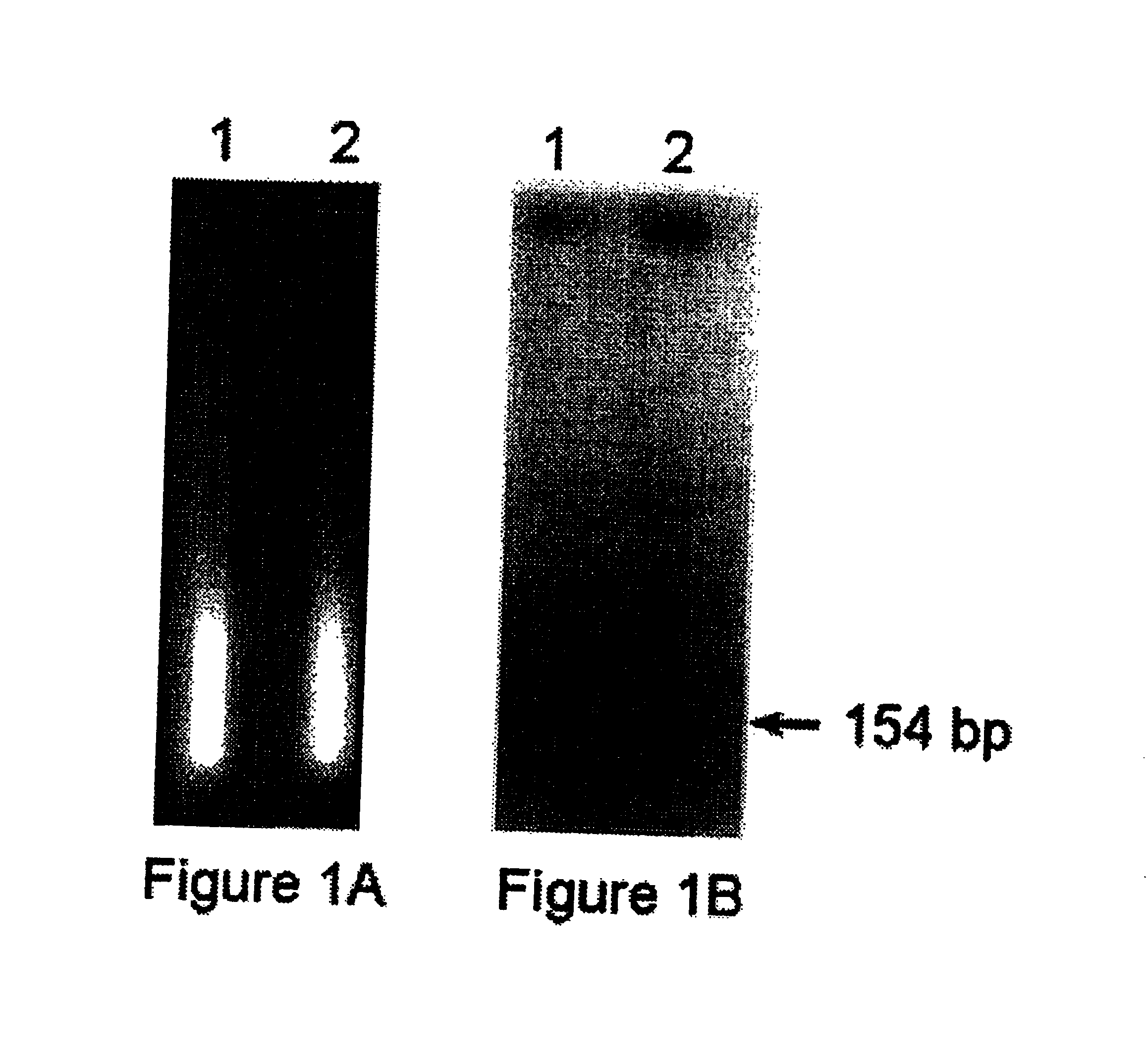 Methods for detection of nucleic acid sequences in urine