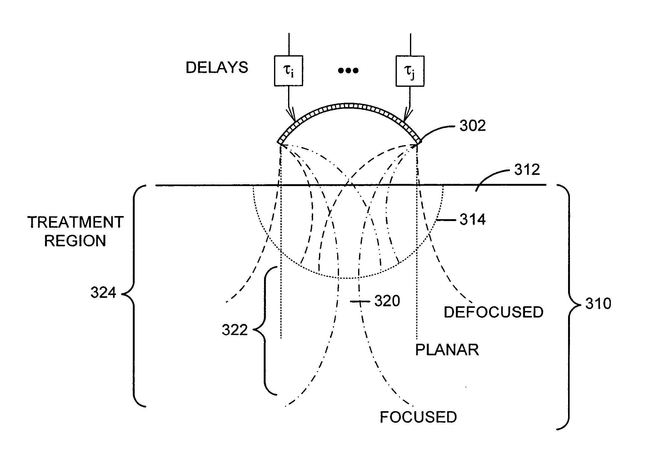 Method and system for combined ultrasound treatment