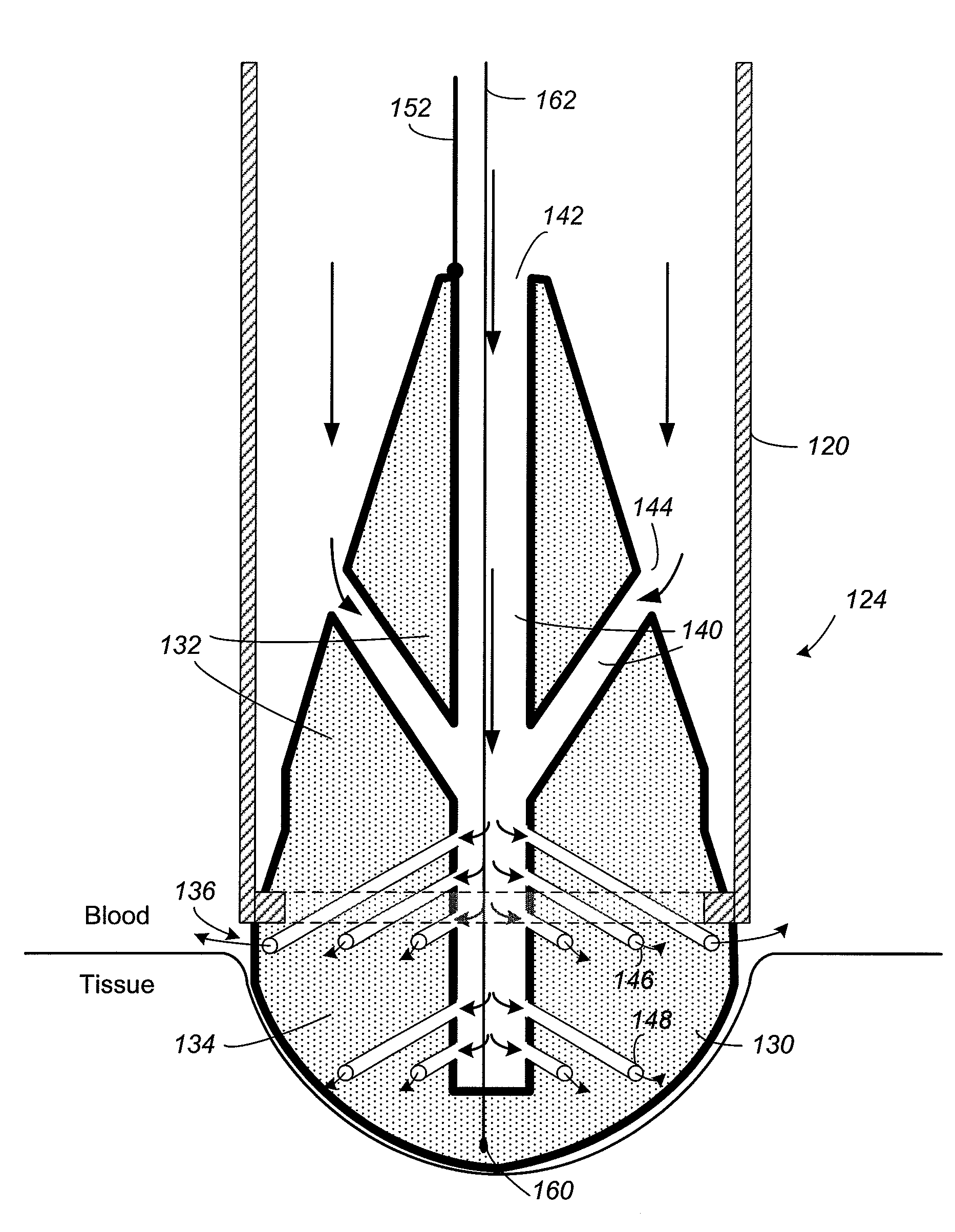 Catheter and Method for Improved Ablation