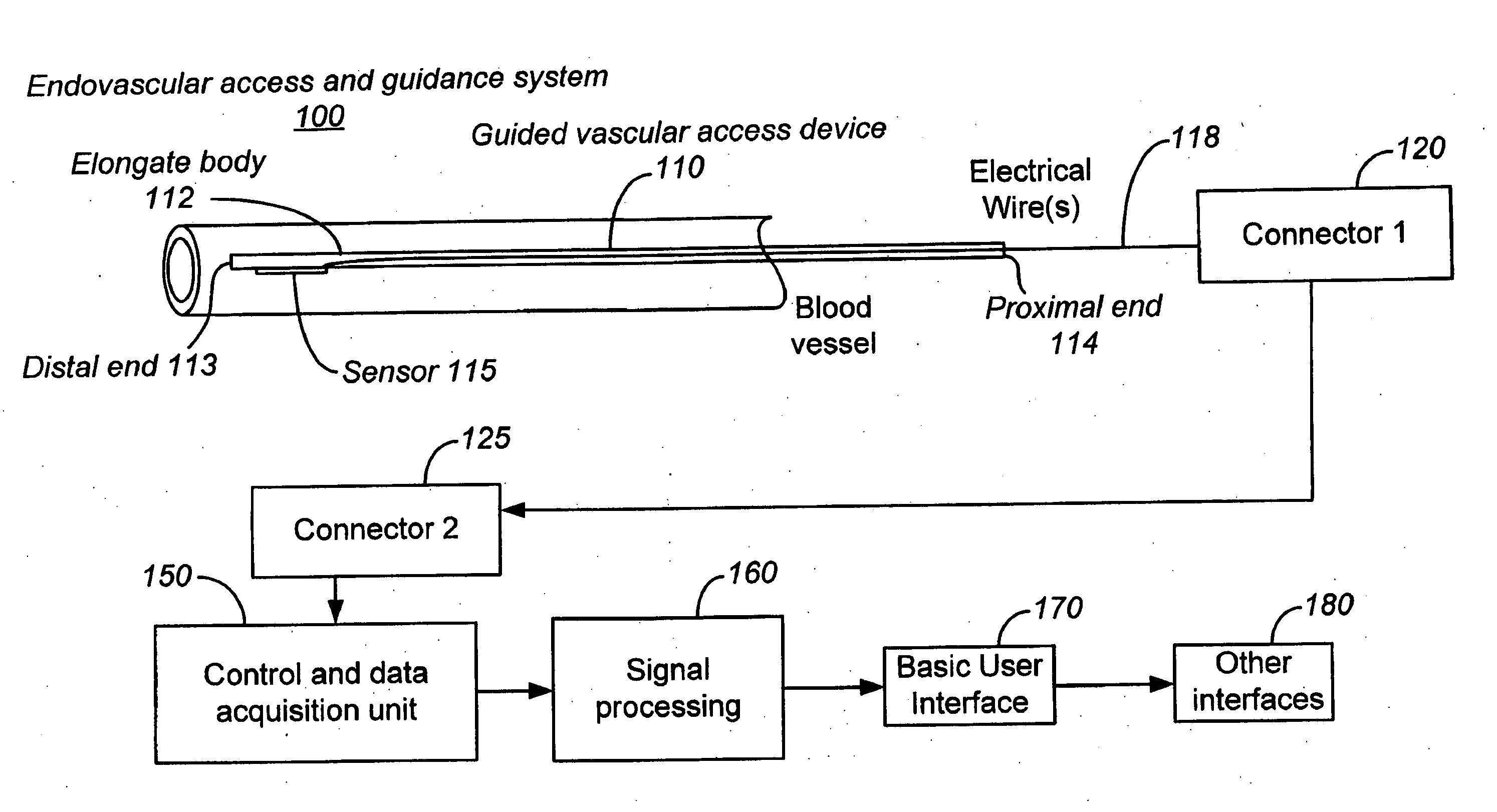 Ultrasound sensor