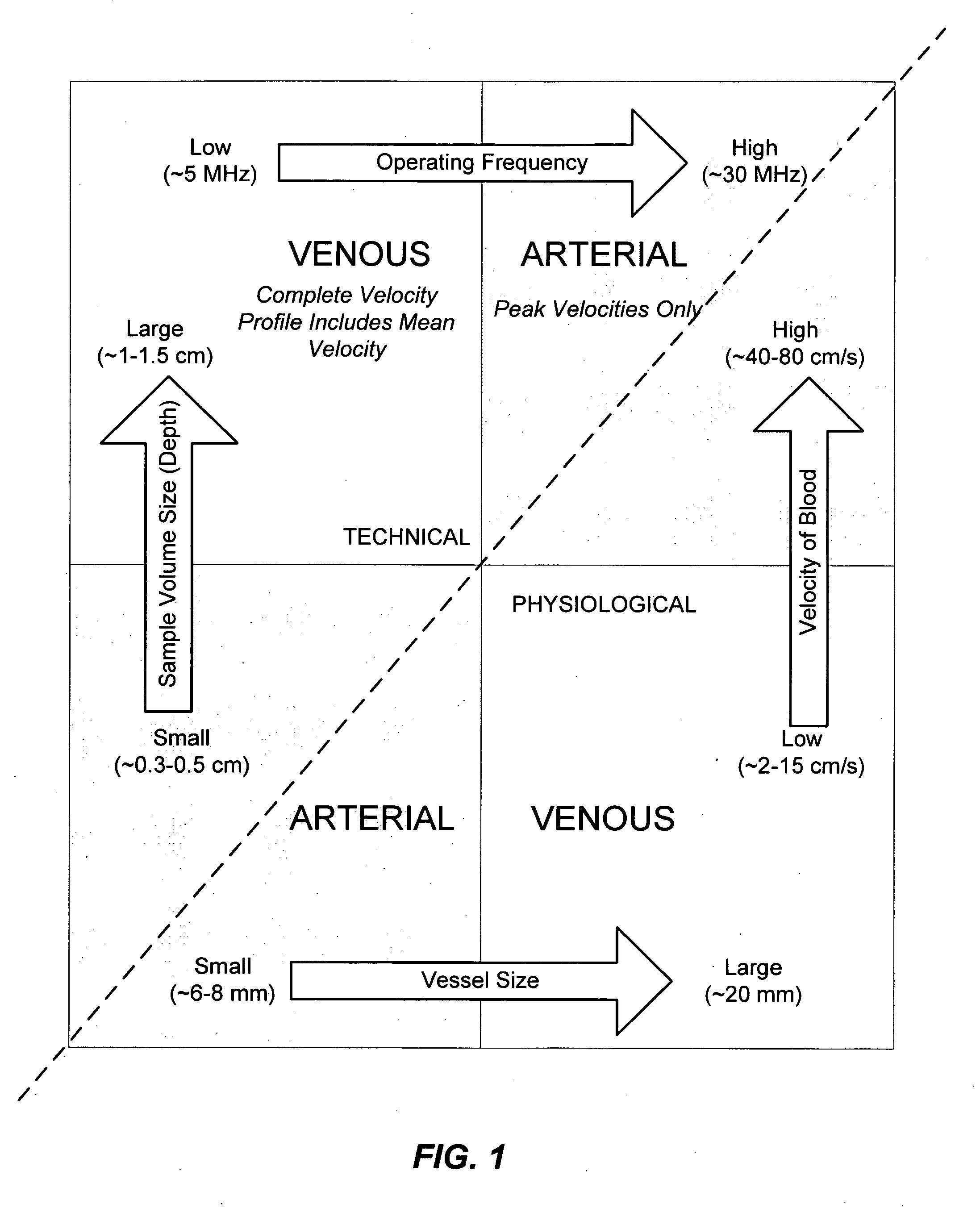 Ultrasound sensor