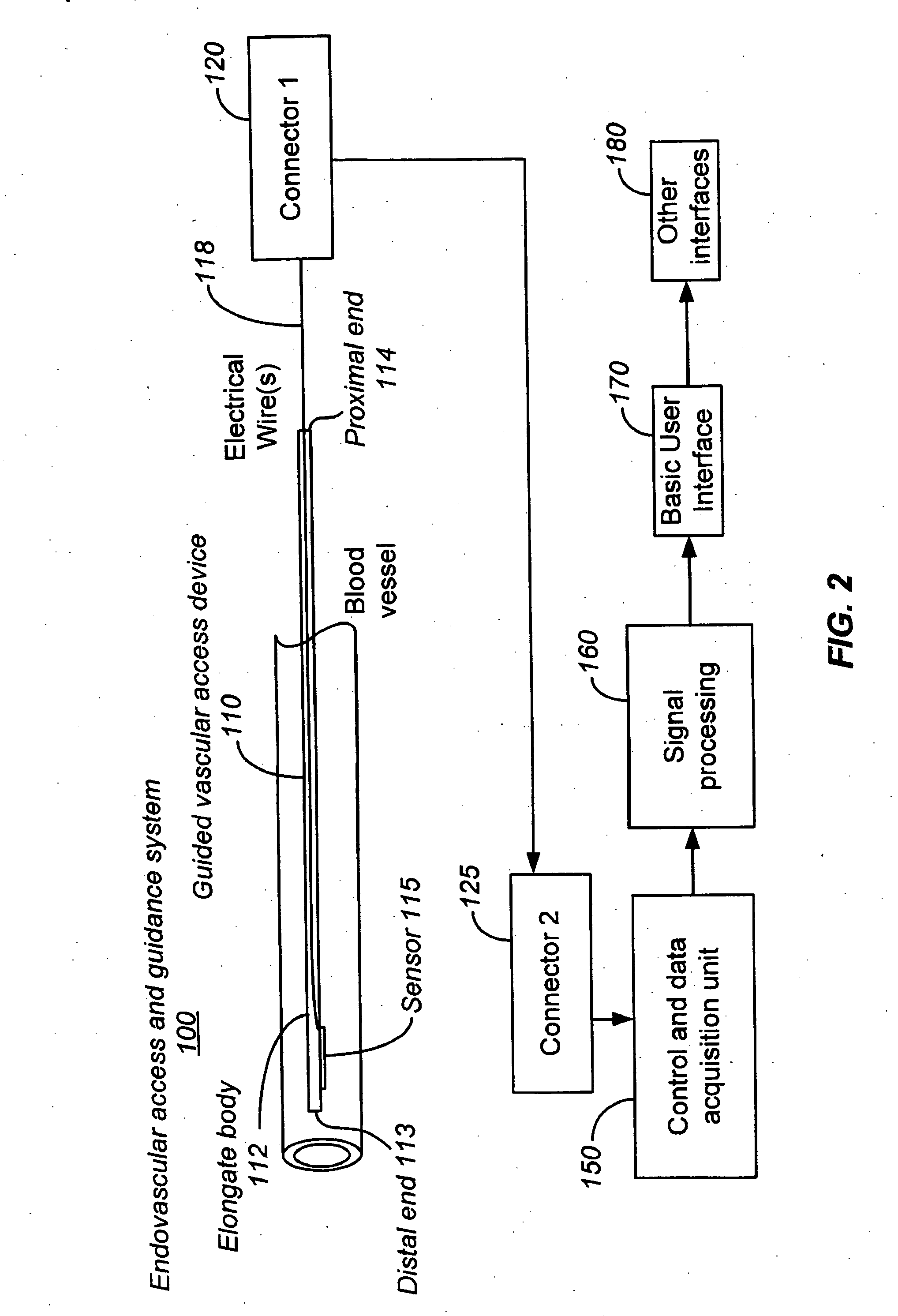 Ultrasound sensor