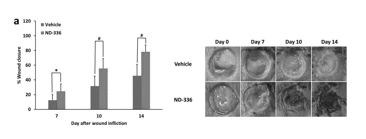 Acceleration of diabetic wound healing