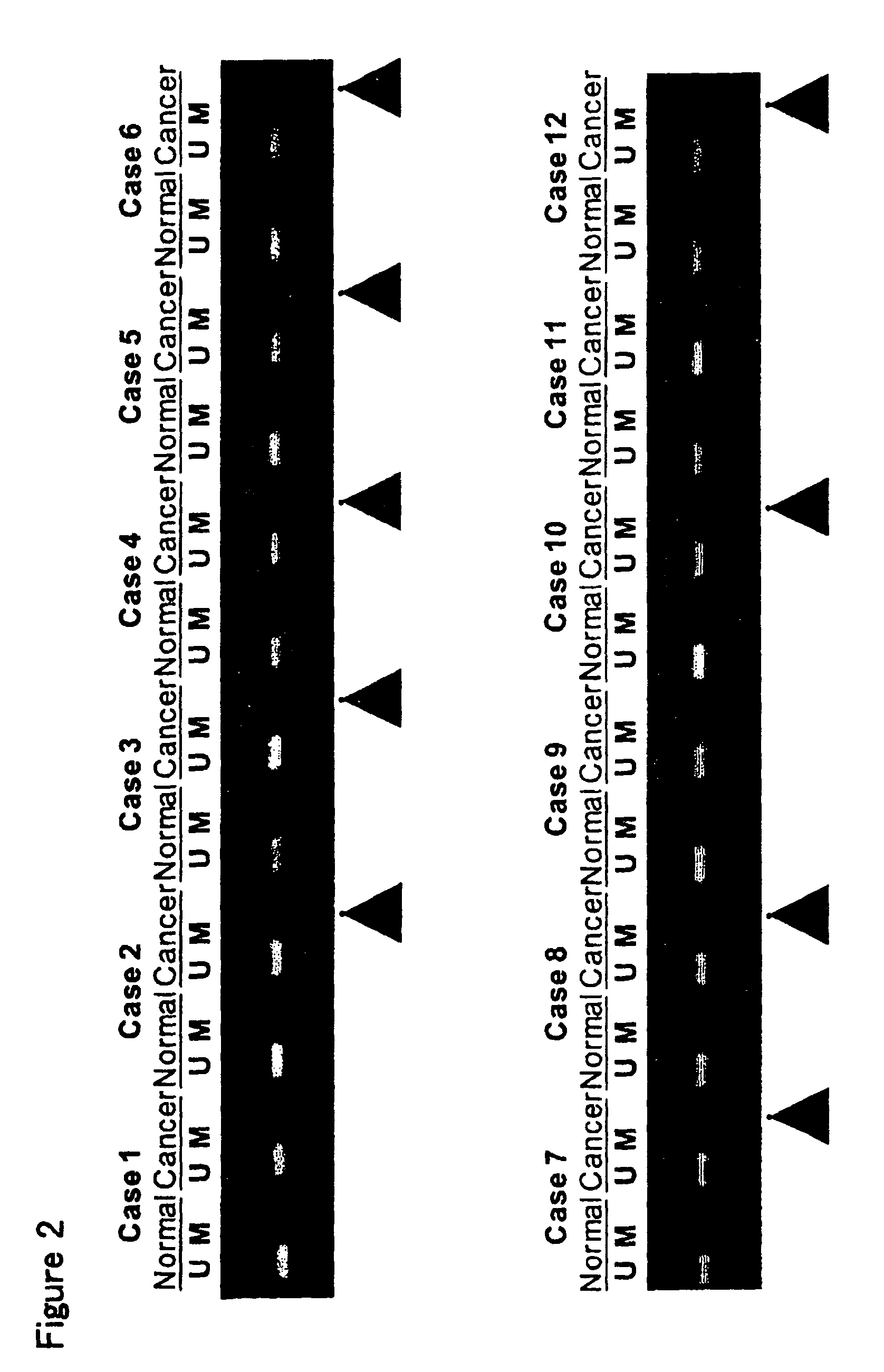 Method for assessing cancerous state