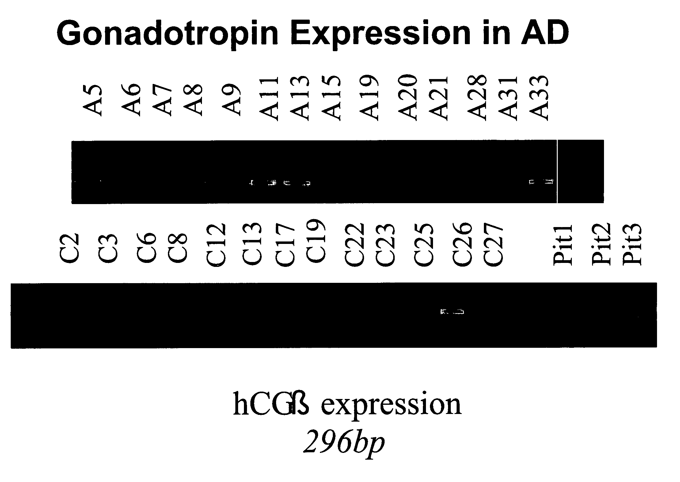 Brain-derived gonadotropins and cognition