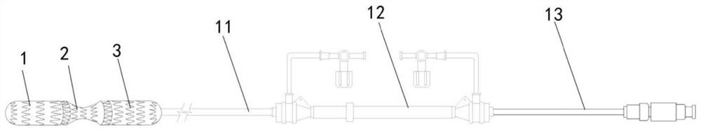 Special model-fitting modularized occluder for promoting thrombosis of pseudocoele of aortic dissection