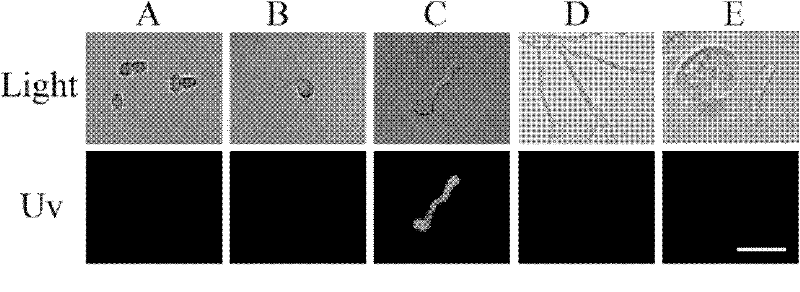 Specific promoter of pathogenic filamentous fungi and use thereof