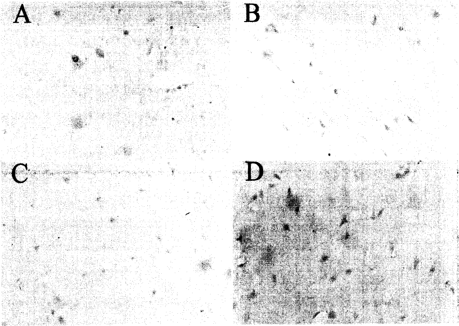 Method for making molecular hybridization using stained old cerebotissue section and its use