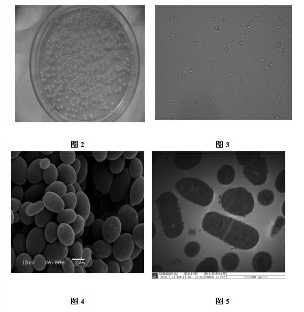 New strain J4 for biofermentation of fruit wine and application thereof