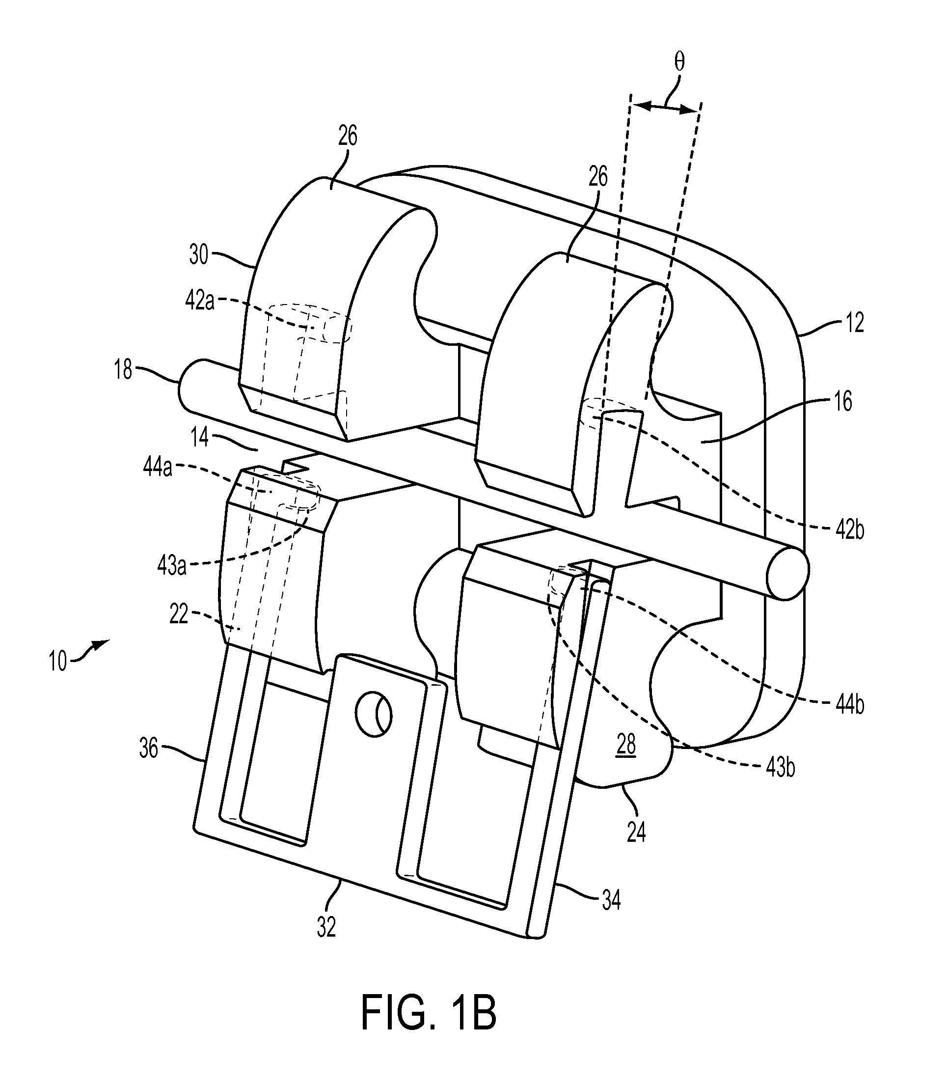 Orthodontic Bracket with Angled, Curved Shutter