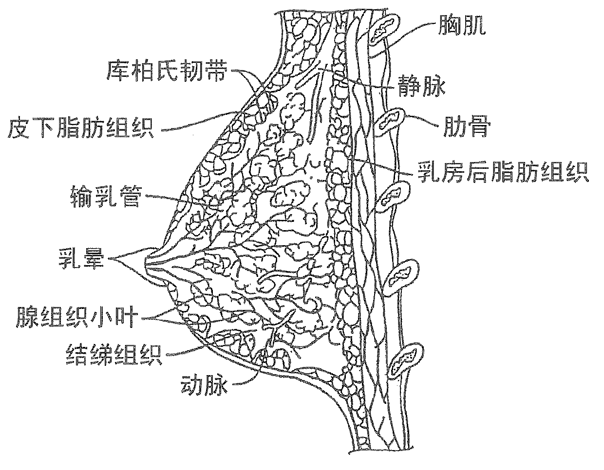 Thermotherapy method for treatment and prevention of cancer in male and female patients and cosmetic ablation of tissue