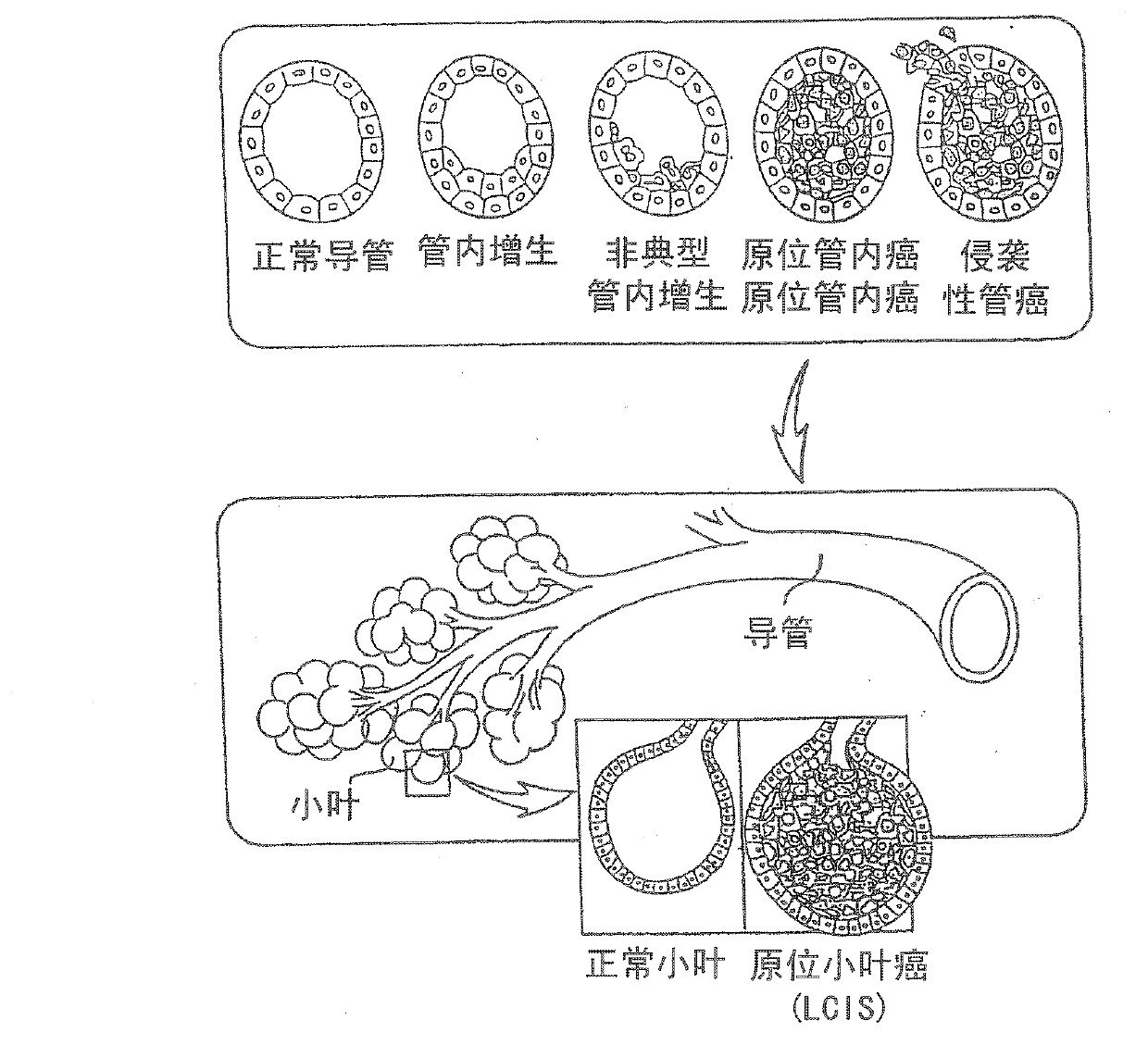 Thermotherapy method for treatment and prevention of cancer in male and female patients and cosmetic ablation of tissue