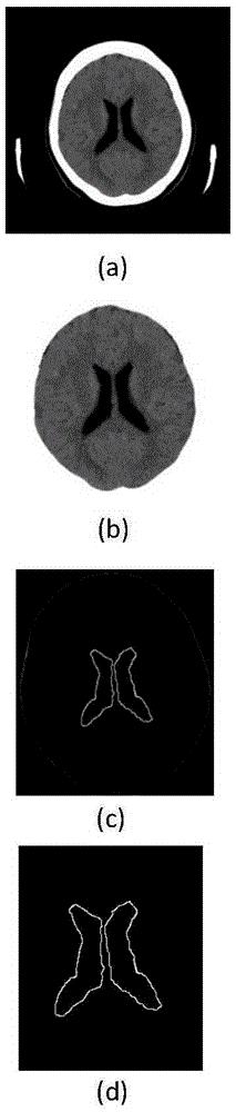 Medical image classification method based on KAP digraph model