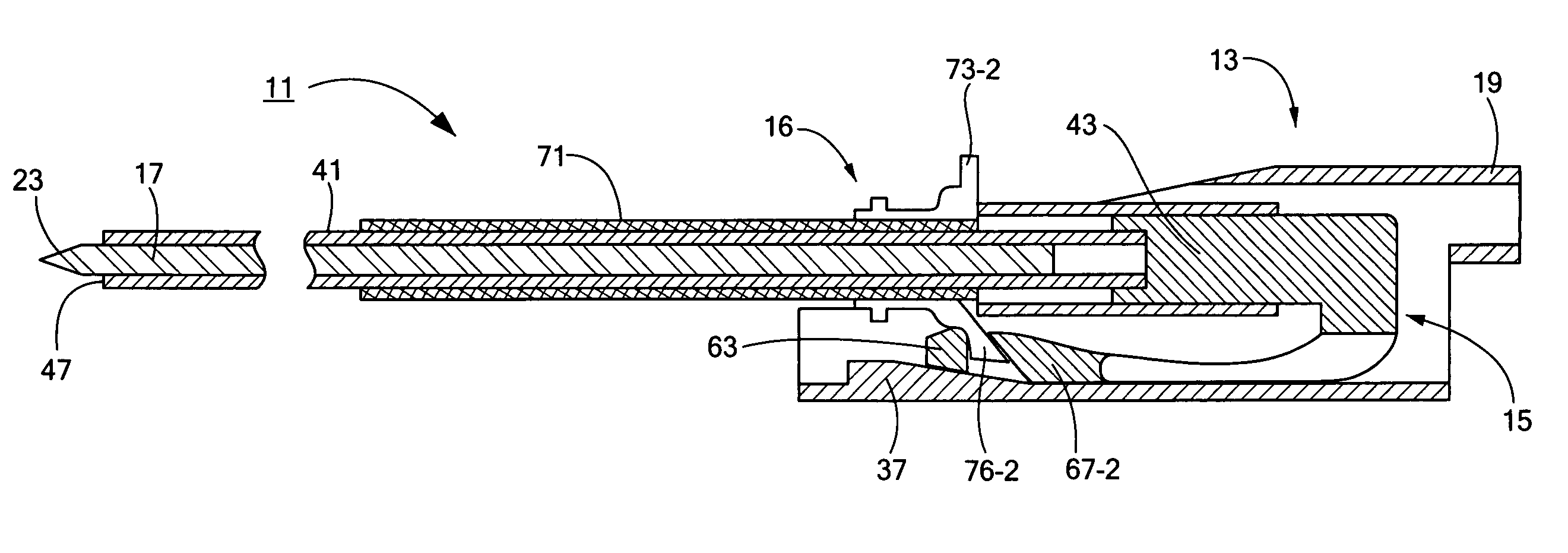 Percutaneous endoscopic jejunostomy access needle