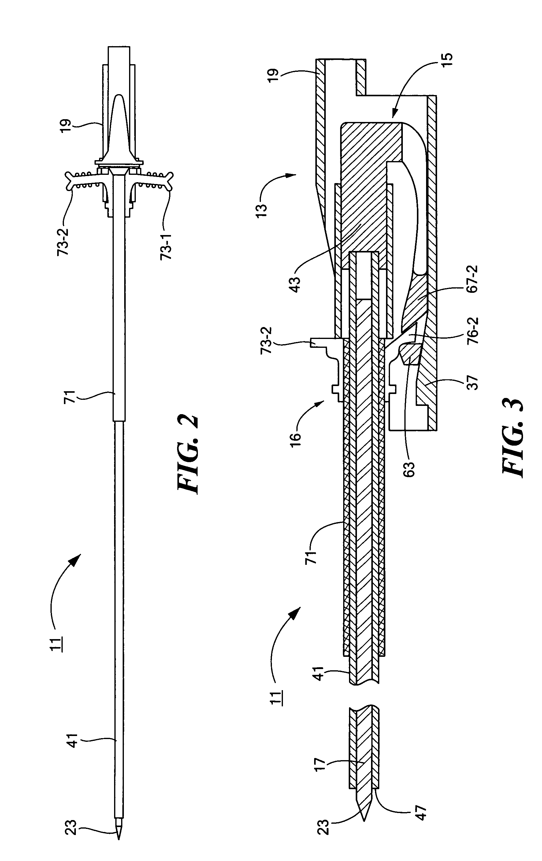 Percutaneous endoscopic jejunostomy access needle